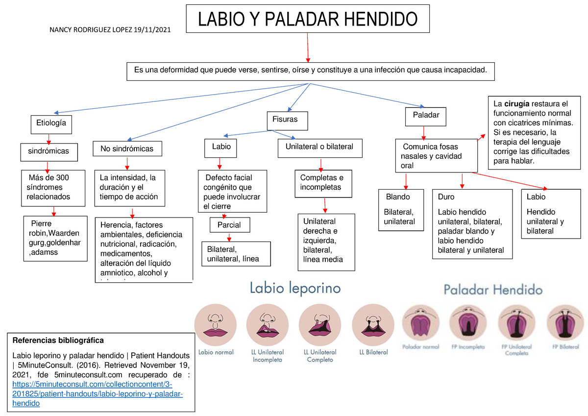 Mapa Conceptual Labio Y Paladar Hendido Y Apendicitis Nancy Rodriguez Lopez Nancy Rodriguez 3202