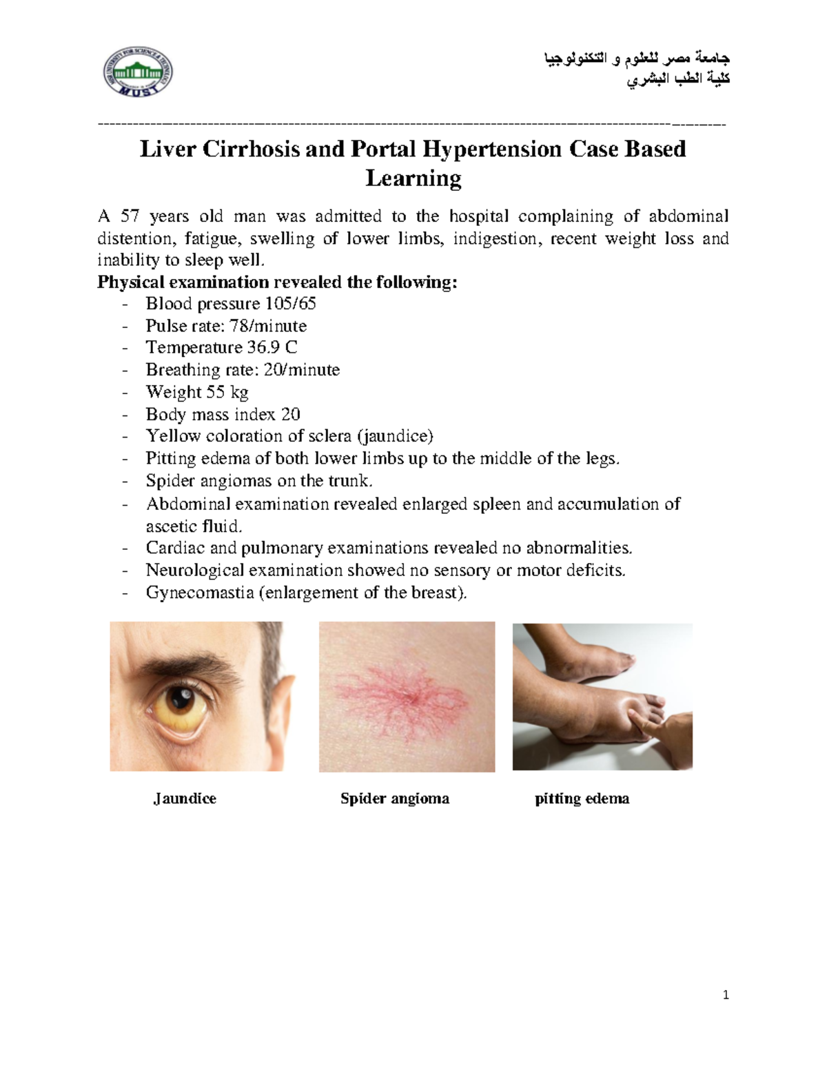 case study for liver cirrhosis