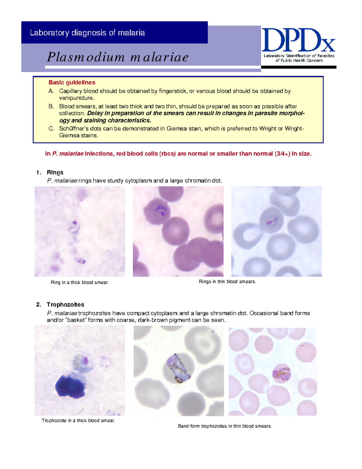 The criteria of a good blood film