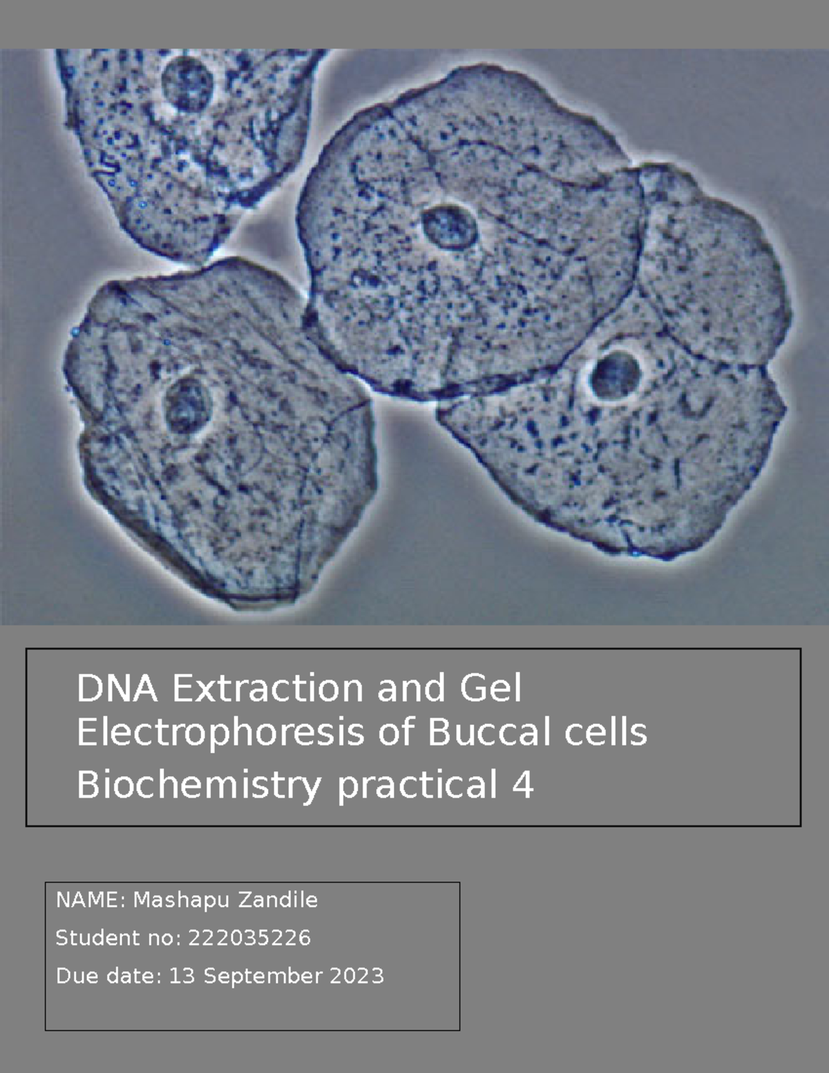 Biochemistry gel electrophoresis 3 - DNA Extraction and Gel ...