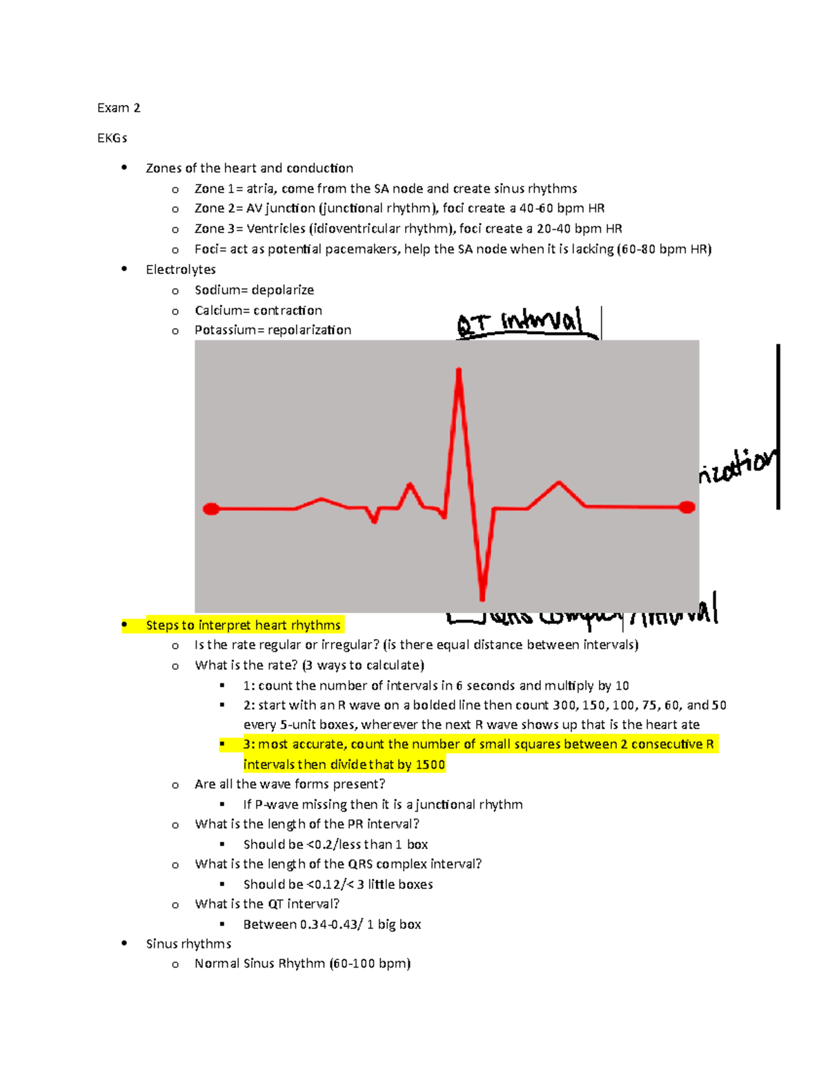 Exam 2 Study guide - N/A - Exam 2 EKGs Zones of the heart and ...