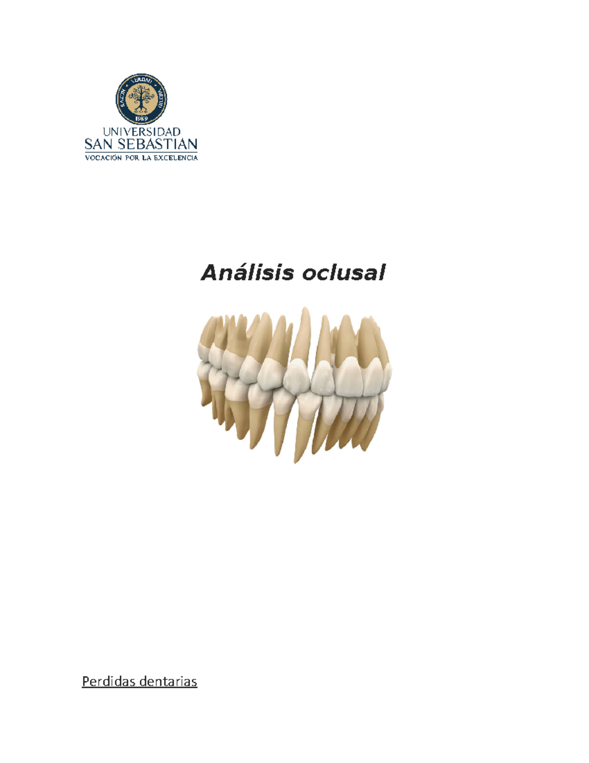 Análisis oclusal - Análisis oclusal Perdidas dentarias La ausencia de ...