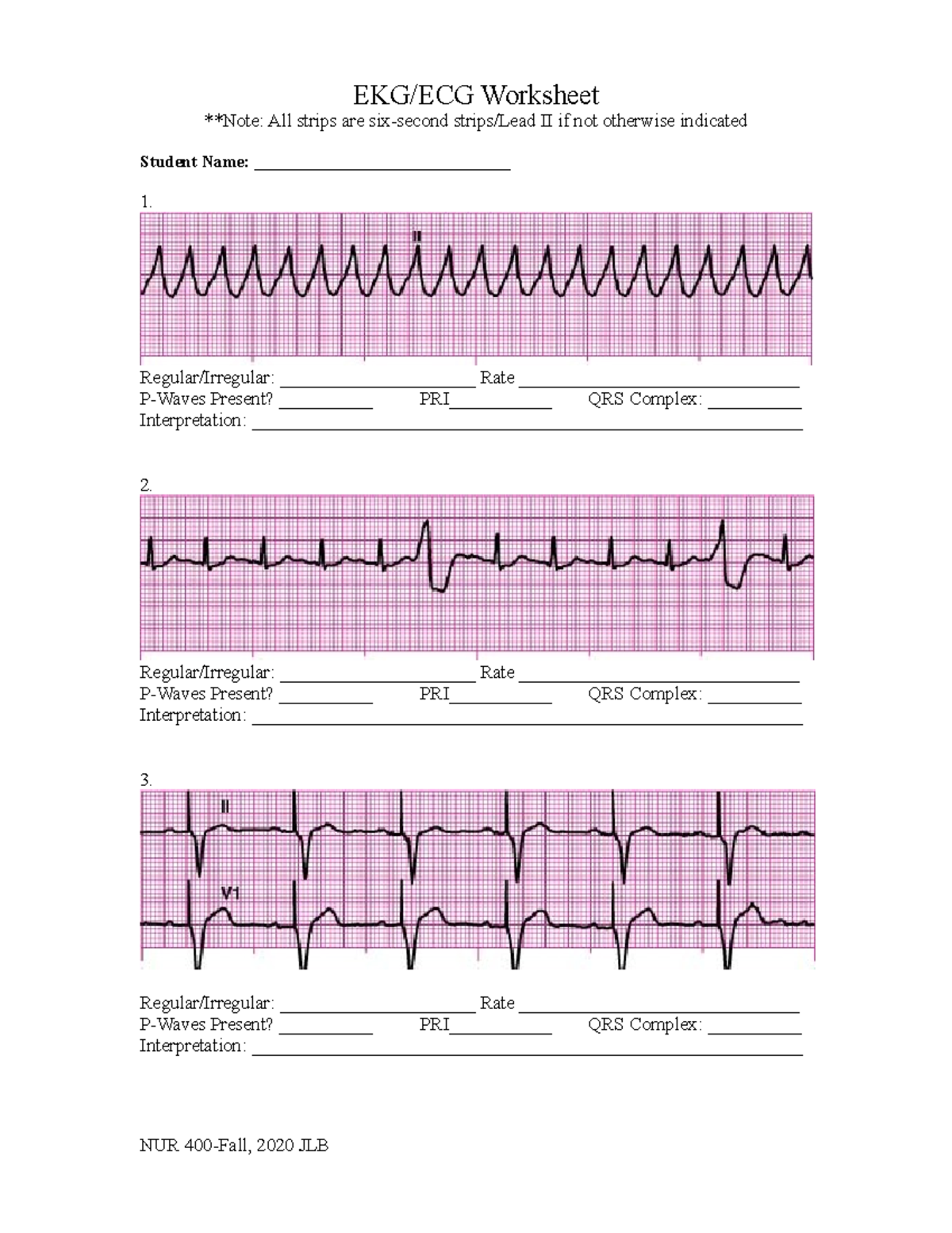 2020 NUR400 EKG Worksheet EKG/ECG Worksheet **Note All strips are