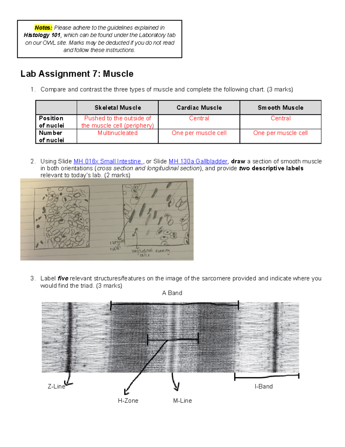 assignment 4 the muscle times needs you