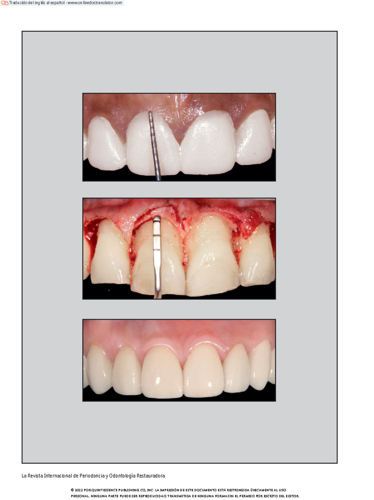 Laser Tools Flexible Crows Pied Clé Set 1/2 " D 9pc 7164