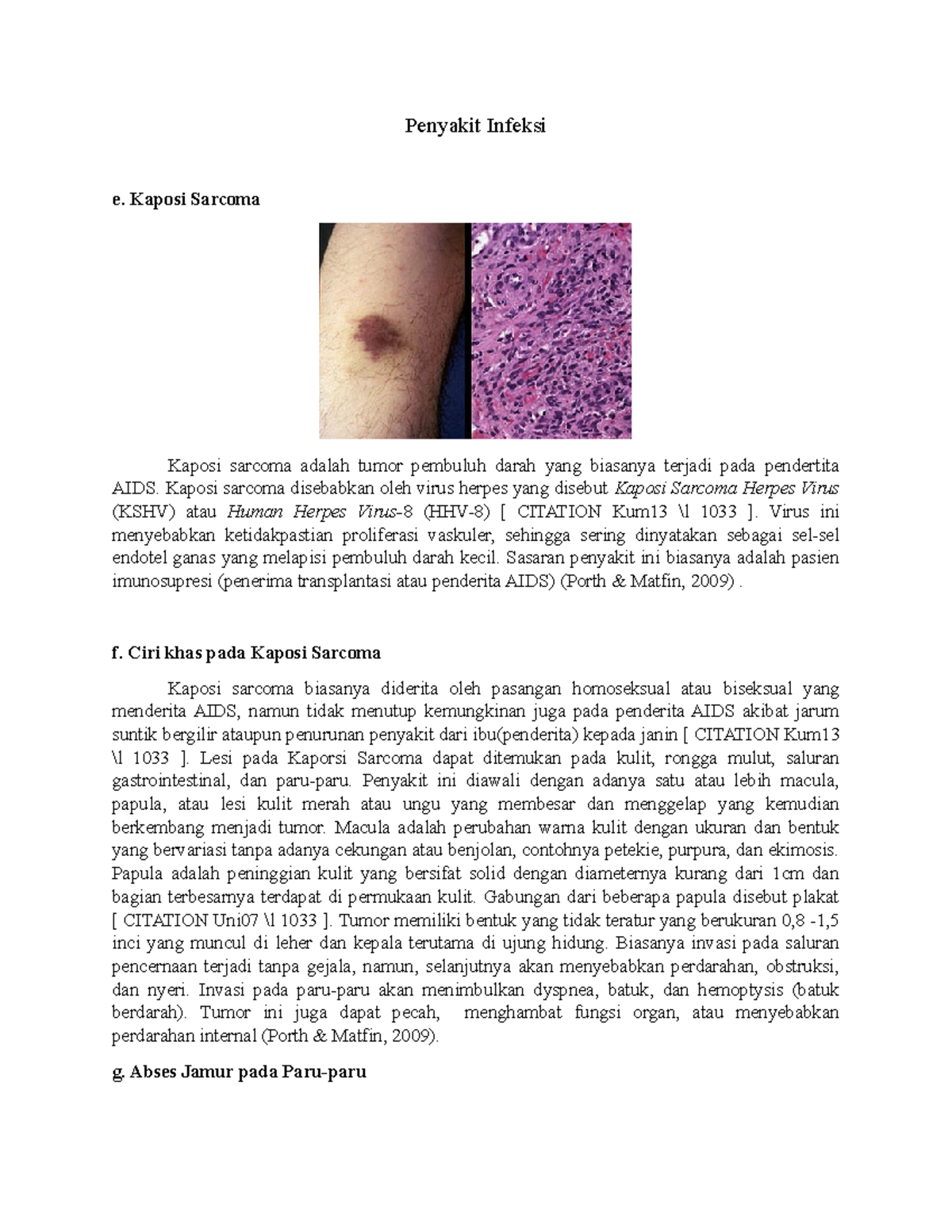 Proses Infeksi Praktik Biomedik Dasar - Penyakit Infeksi E. Kaposi ...