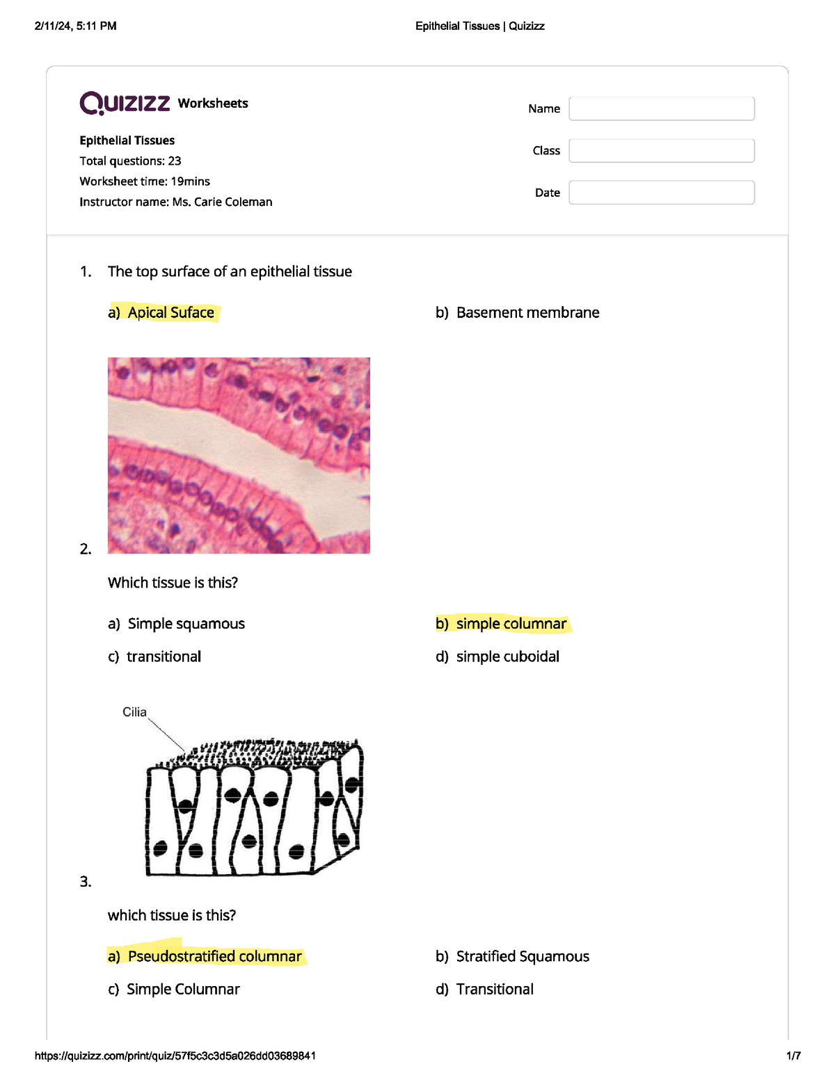 Epithelial - Quizizz Worksheets Epithelial Tissues Total questions: 23 ...