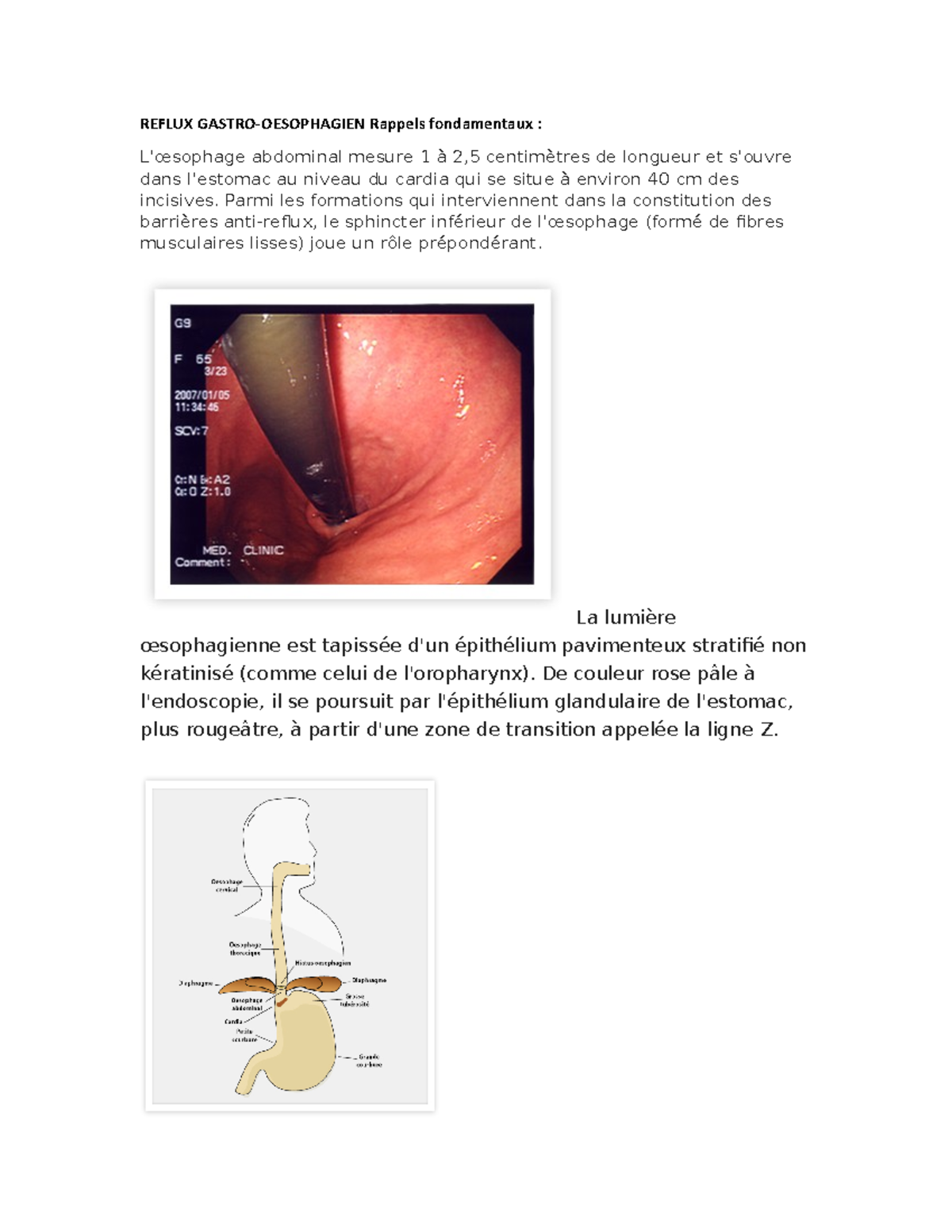 med-cours-1-reflux-gastro-oesophagien-rappels-fondamentaux-l
