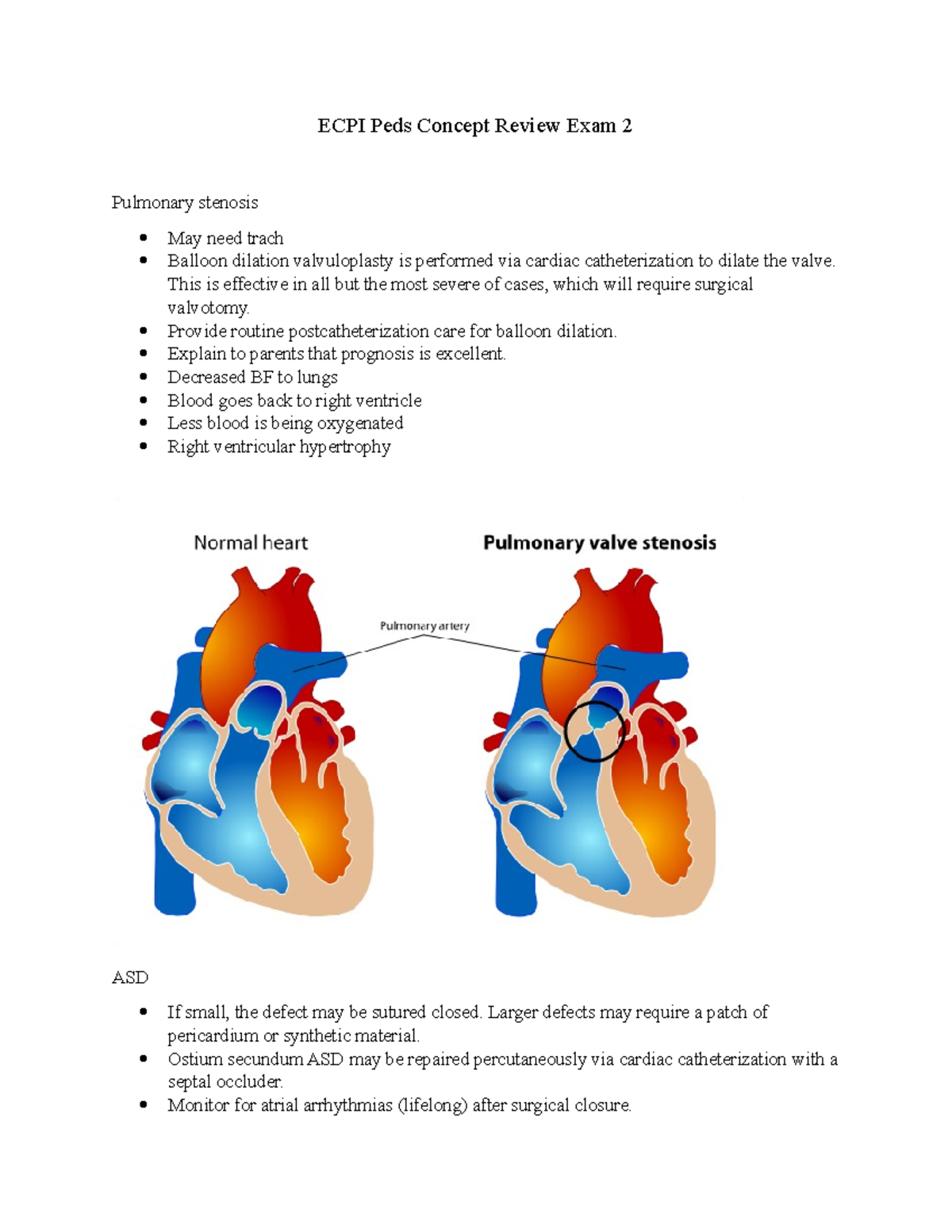 Peds Exam 2 review - ECPI Peds Concept Review Exam 2 Pulmonary stenosis ...