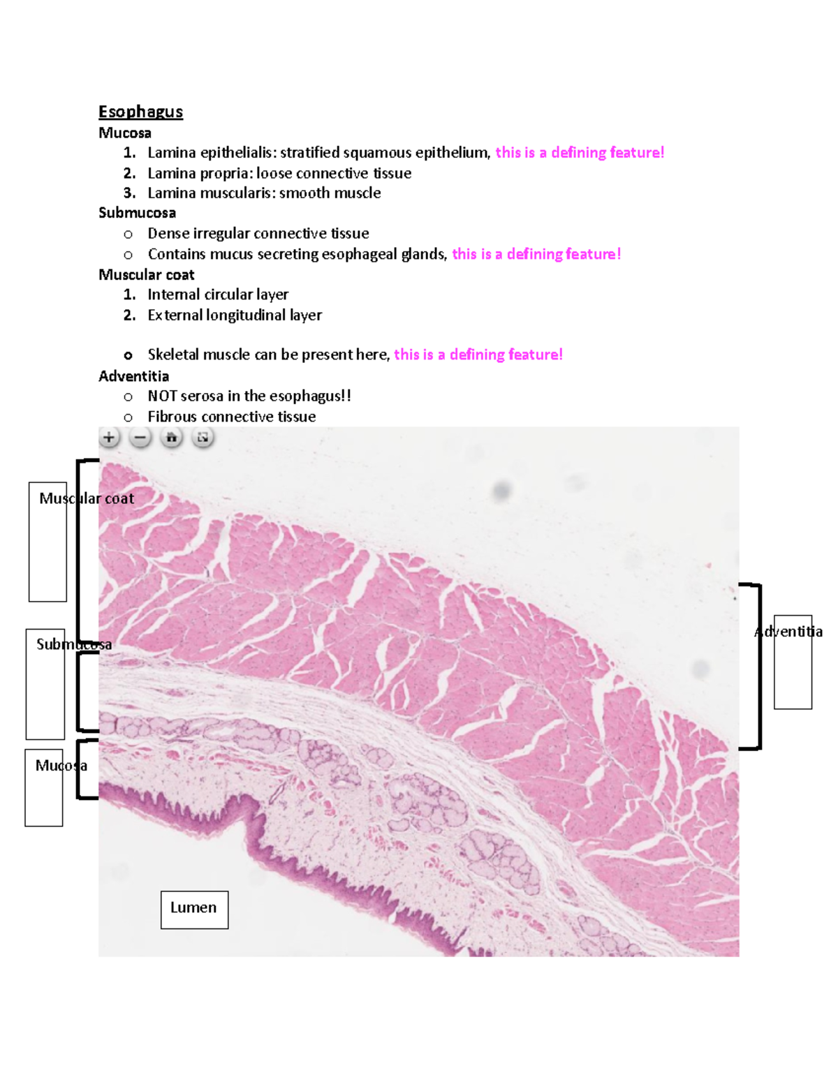 Digestive Histology - Esophagus Mucosa 1. Lamina epithelialis ...