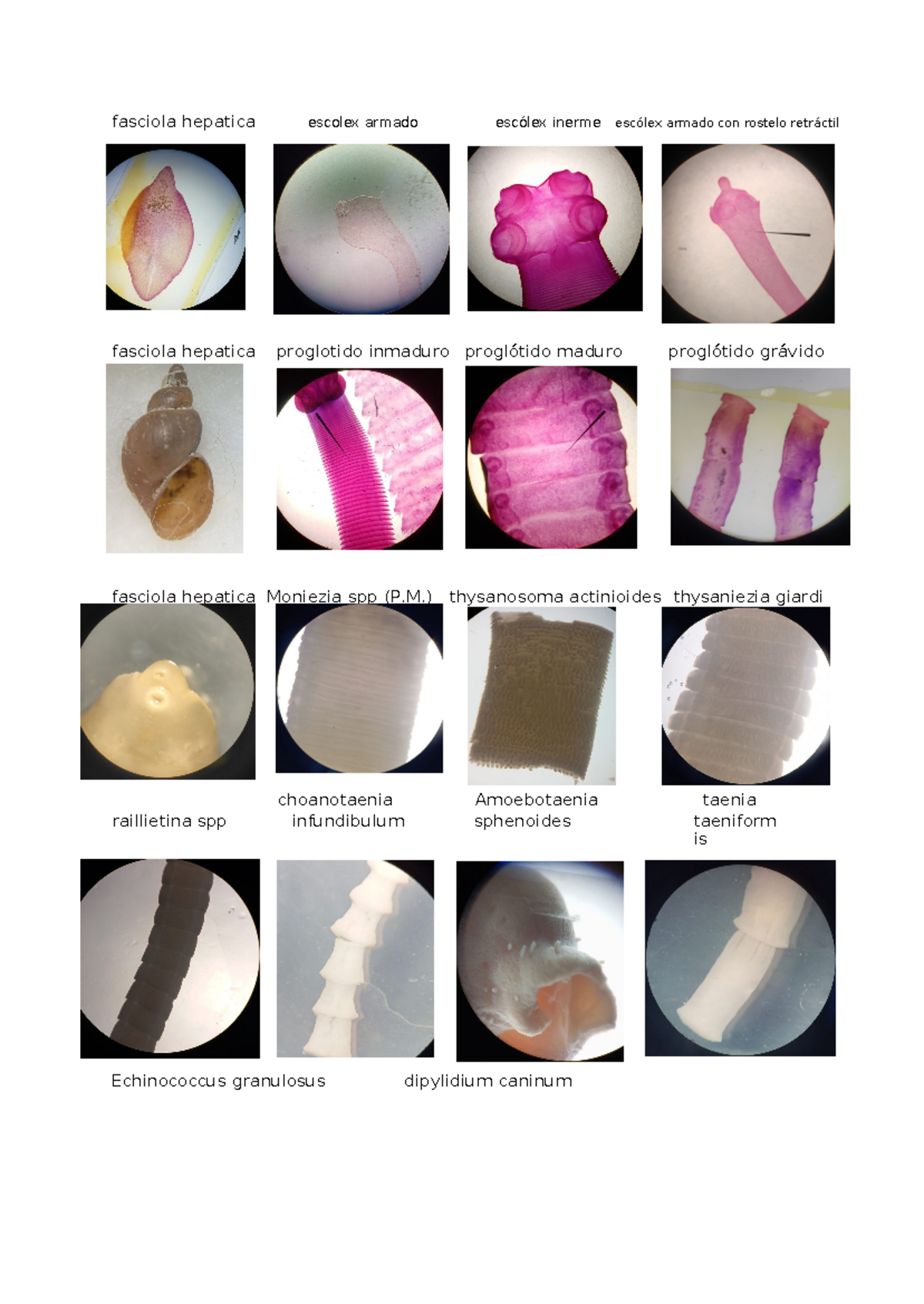 Para practico fotos - fasciola hepatica escolex armado escólex inerme ...