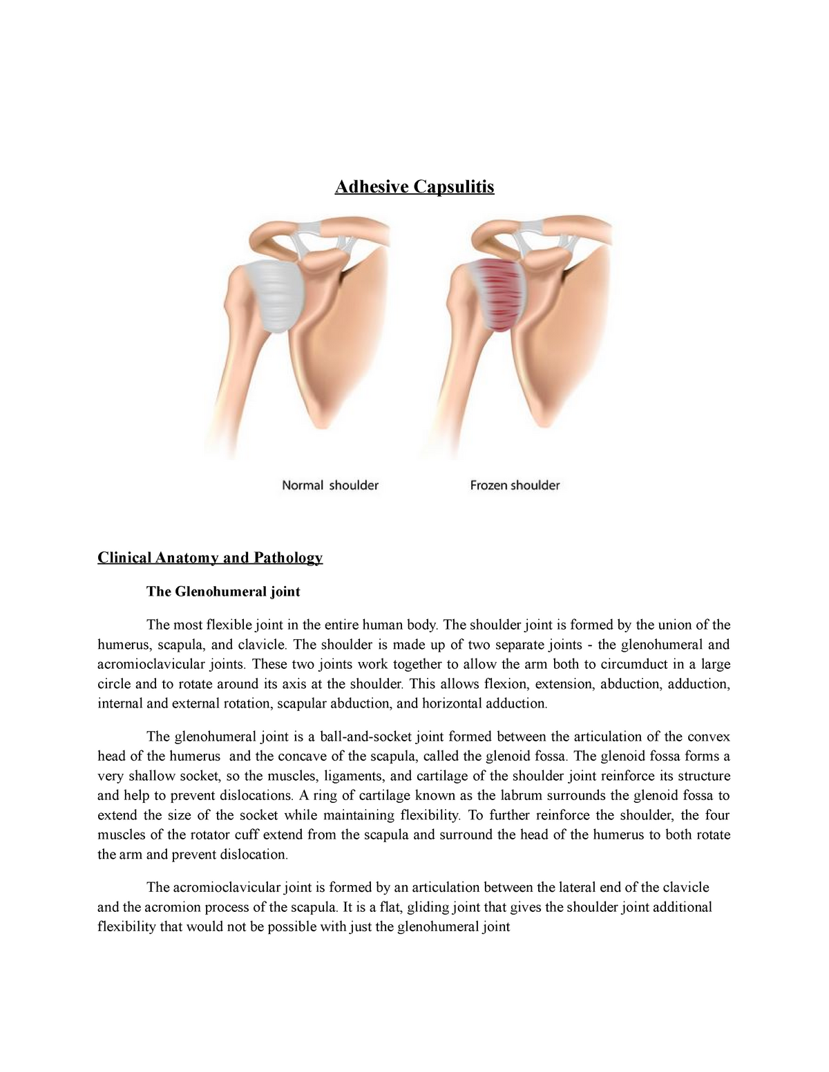 Adhesive Capsulitis A Detailed Discussion About Adhesive Capsulities My Xxx Hot Girl