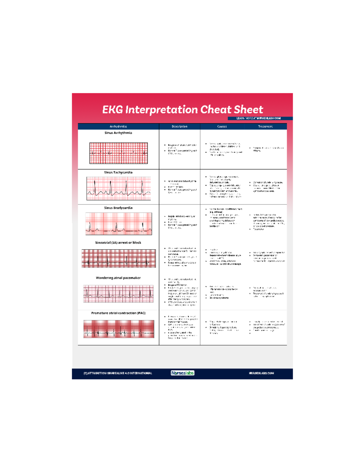 EKG-Interpretation-Cheat-Sheet-for-Heart-Arrhythmias Nurseslabs 1 ...