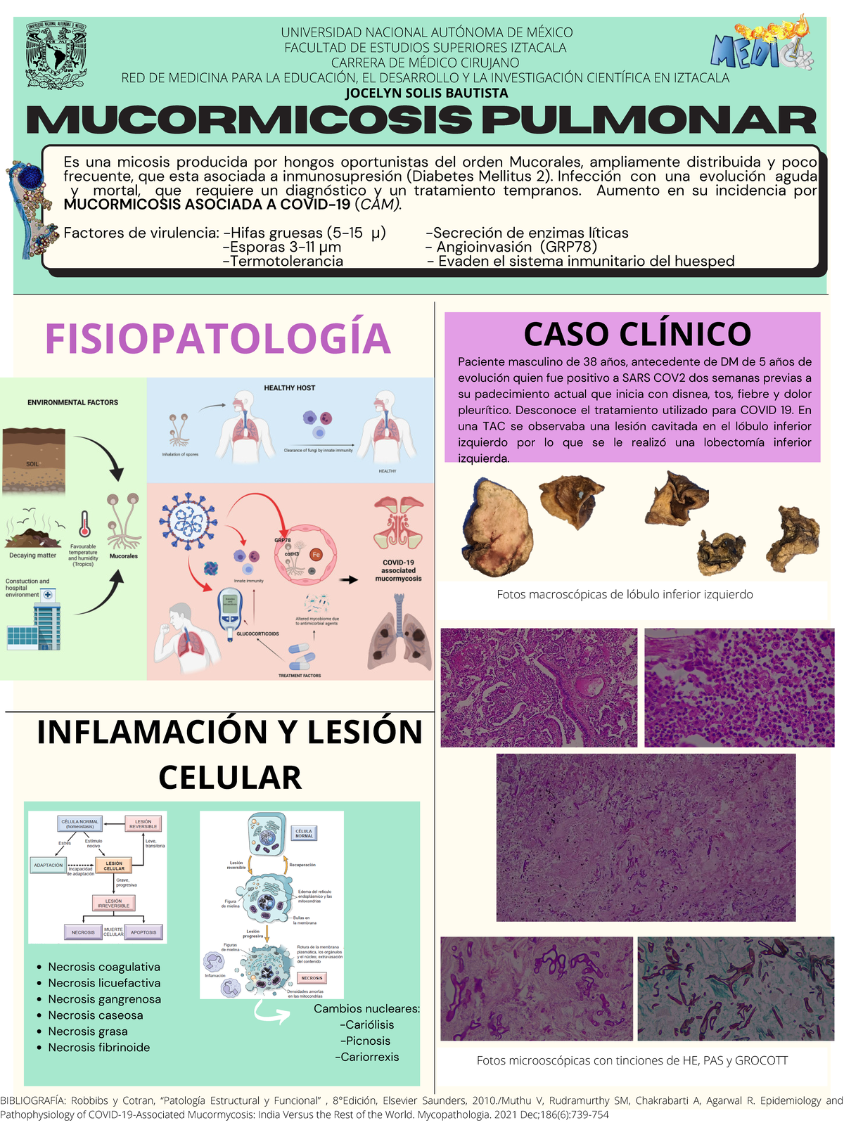 Mucormicosis Pulmonar Mucormicosis Pulmonar Es Una Micosis Producida