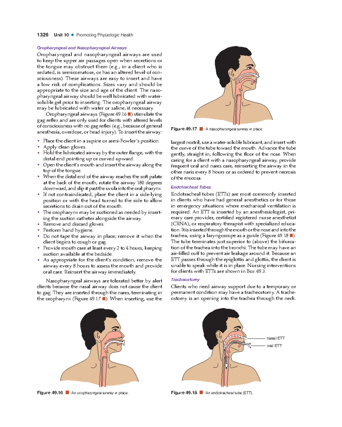 Suctioning - Book - 1326 Unit 10 • Promoting Physiologic Health ...