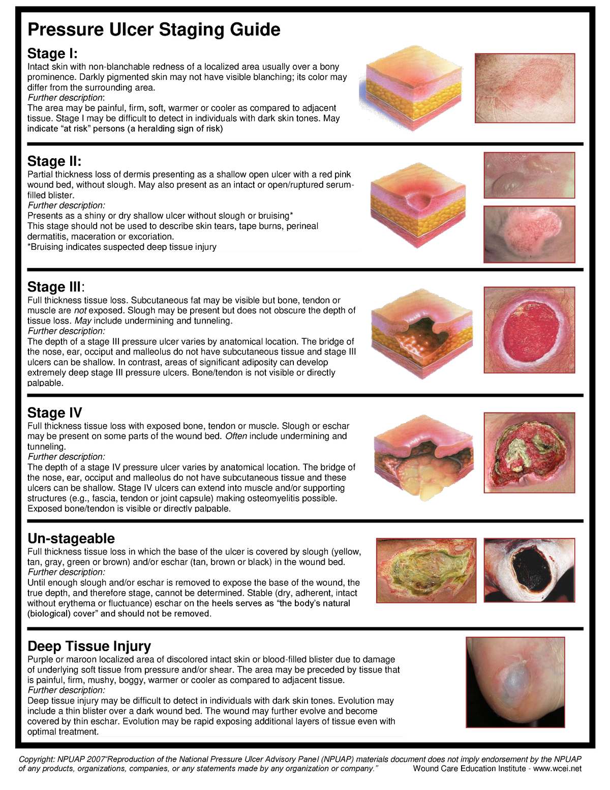 CNUR 101 pressure ulcer - Stage I: Intact skin with non-blanchable ...