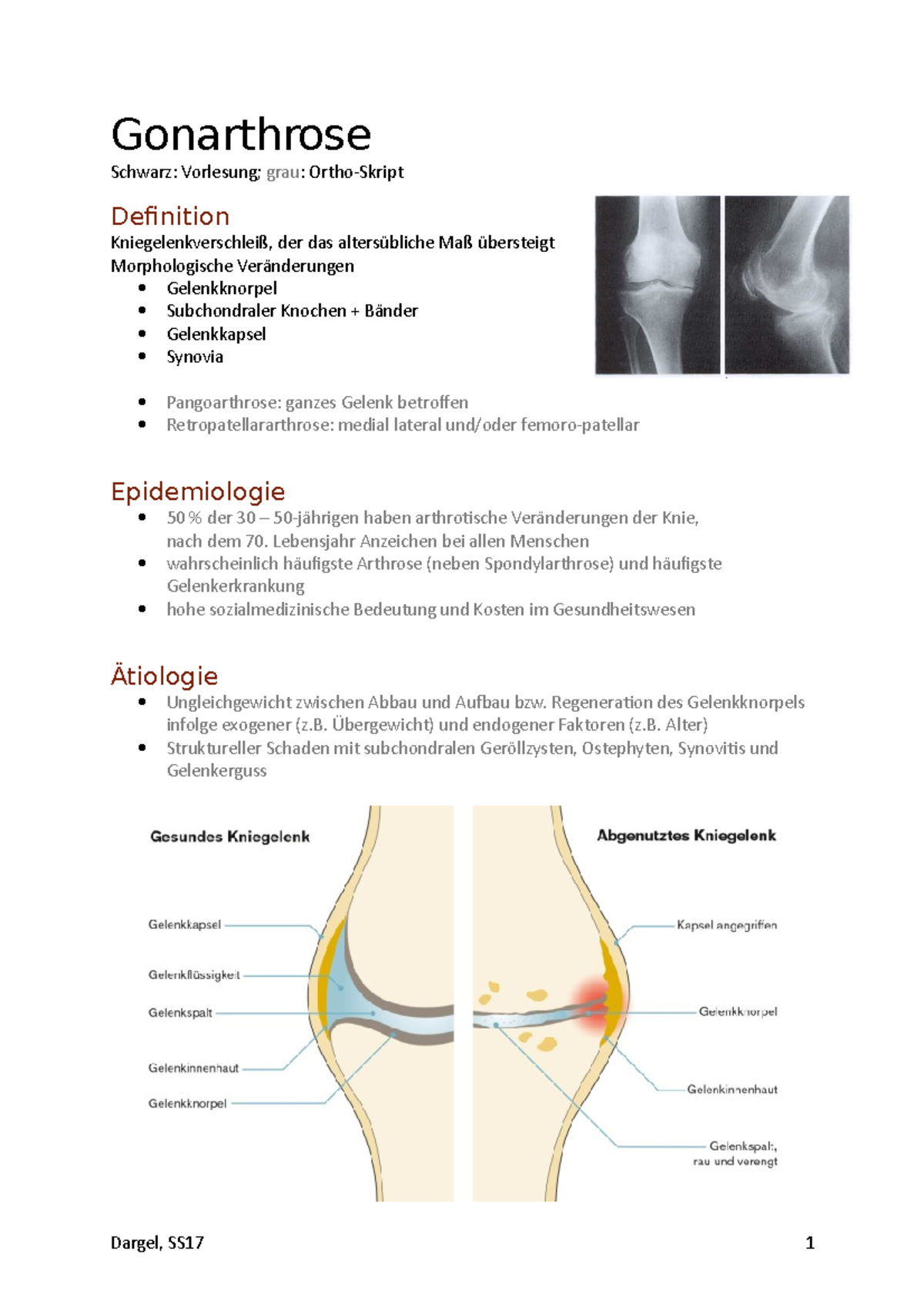 Gonarthrose - Übungen - Gonarthrose Schwarz: Vorlesung; grau: Ortho ...