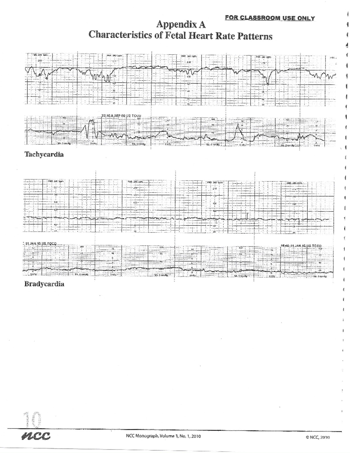 Electronic Fetal Monitoring FHR Patterns NUR3760 Studocu