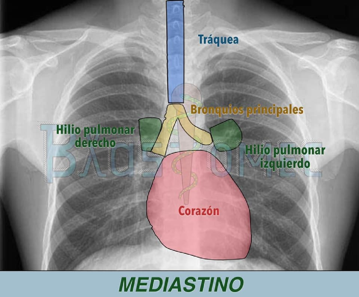 Radiografias normales - Tráquea Bronquios principales io pulmonar ...