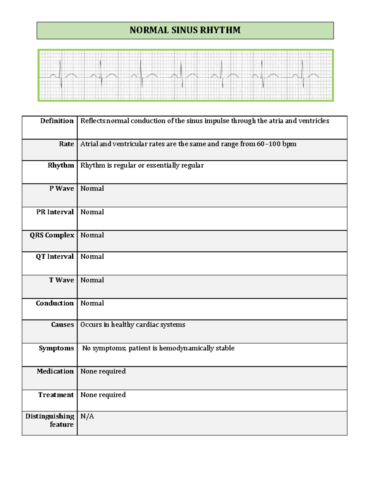 EKG dysrhythmias - Notes - Definition Reflects normal conduction of the ...