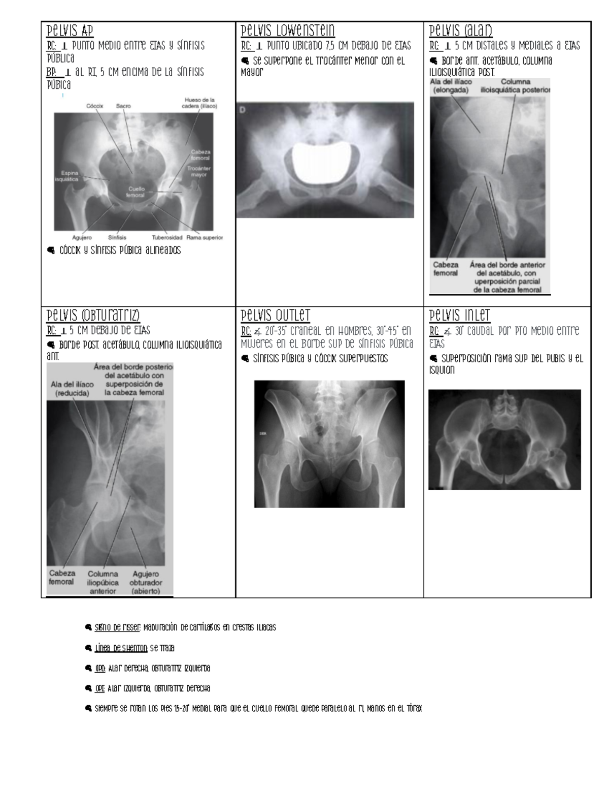 rx Pelvis tabla - @ Signo de risser: maduración de cartílagos en ...
