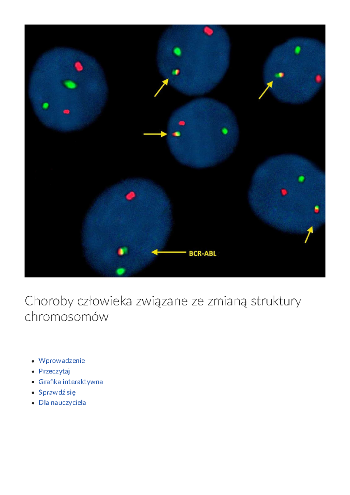 Choroby A Zdrowie Człowieka Sprawdzian