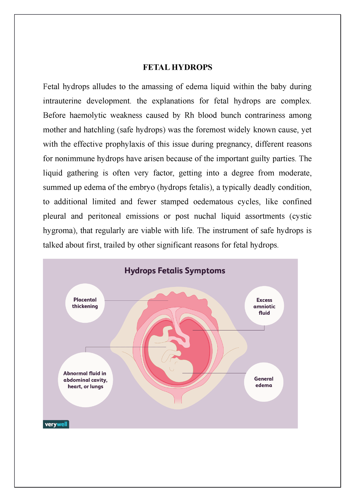 Fetal Hydrops - FETAL HYDROPS Fetal Hydrops Alludes To The Amassing Of ...