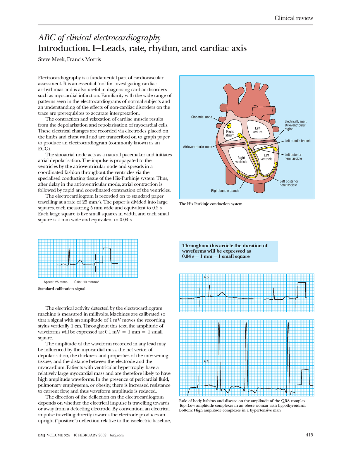 1 Introduccion - apuntes - ABC of clinical electrocardiography ...