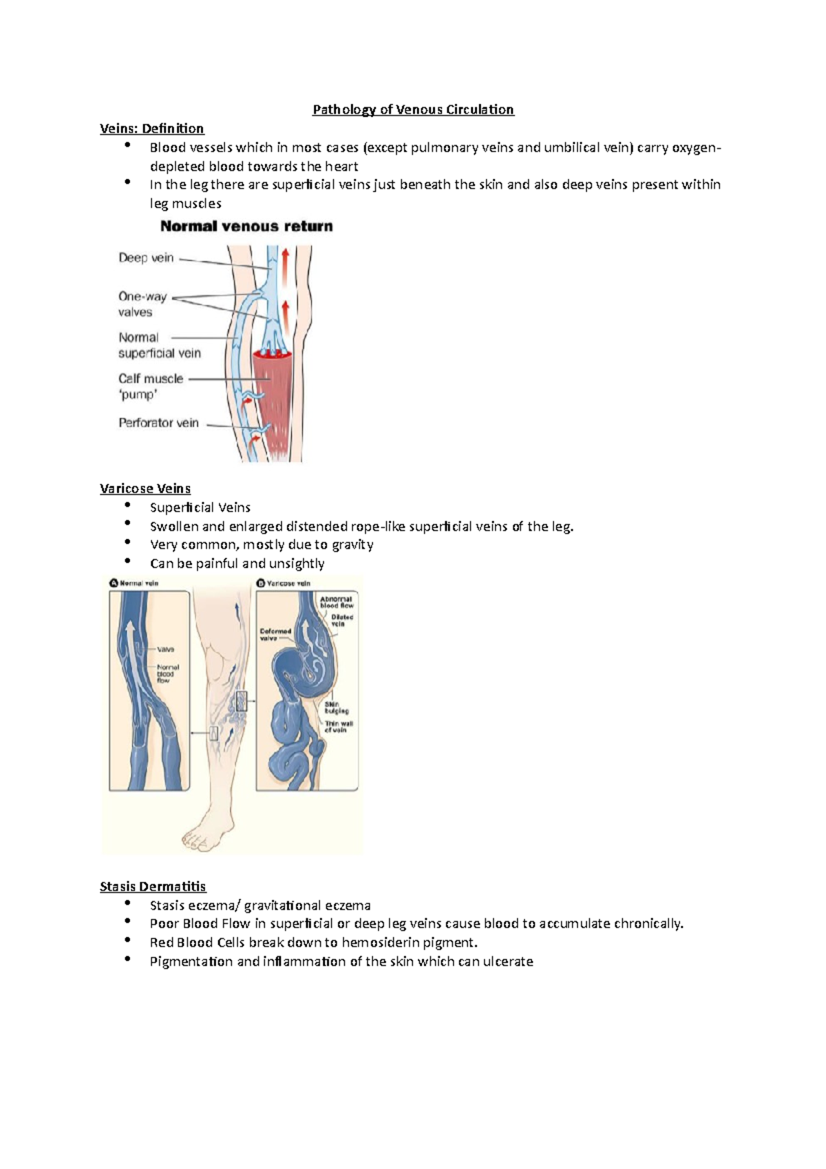 Pathology of Venous Circulation - Pathology of Venous Circulation Veins ...