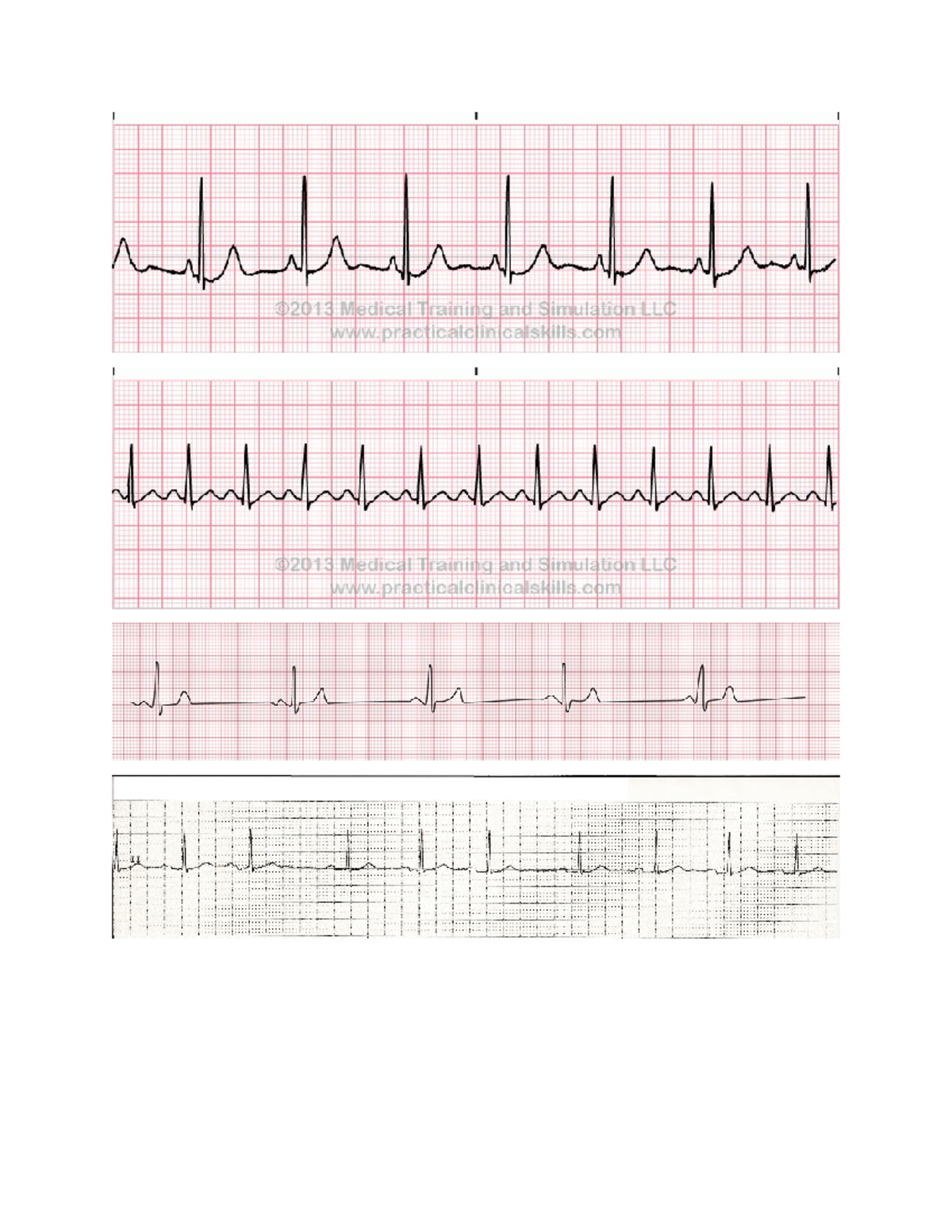 Heart - BIOL 2402 - Studocu