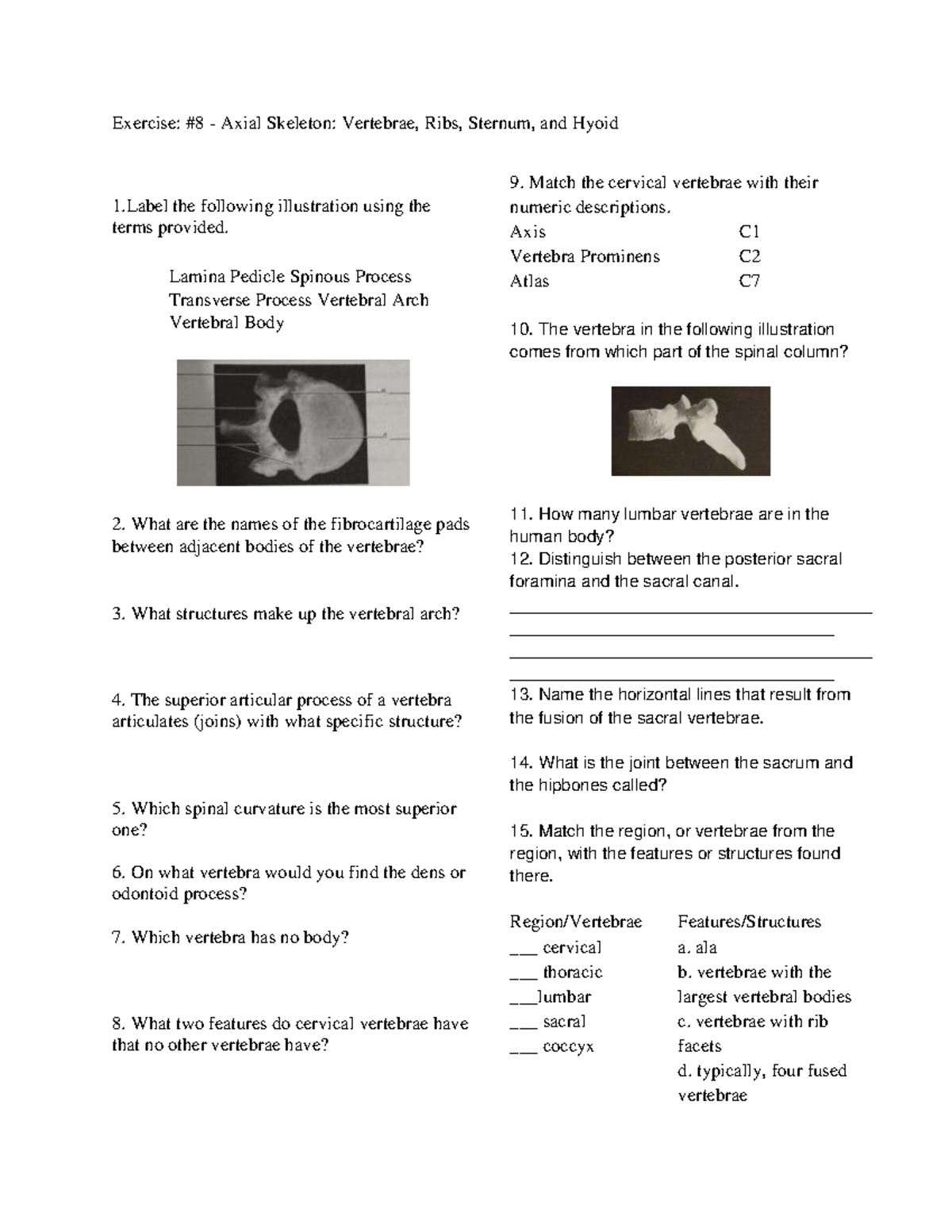 exercise 8 to 10 Exercise 8 Axial Skeleton Vertebrae, Ribs