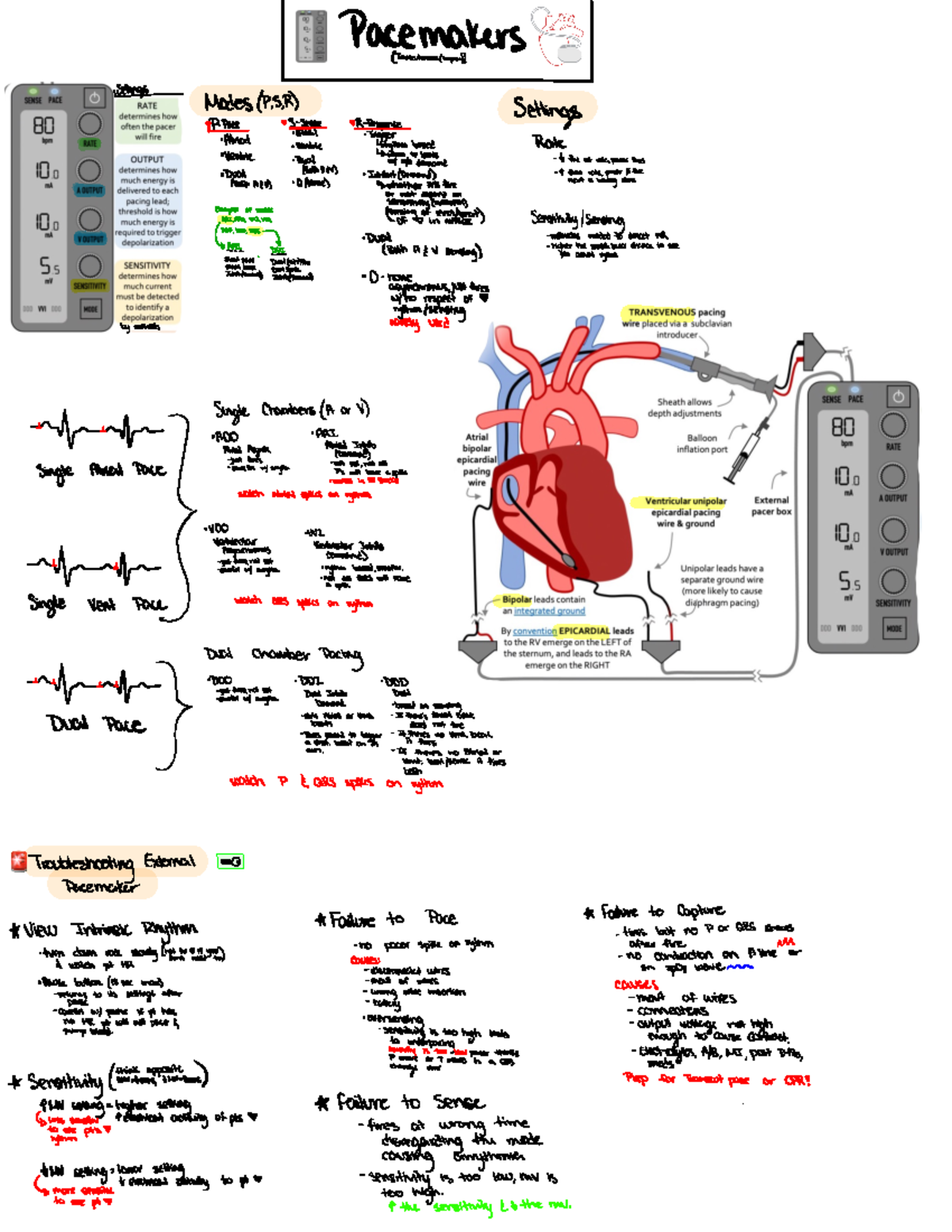 Pacemaker Notes - cardiac chapter on pacer - 🚨 Pacemakers ...