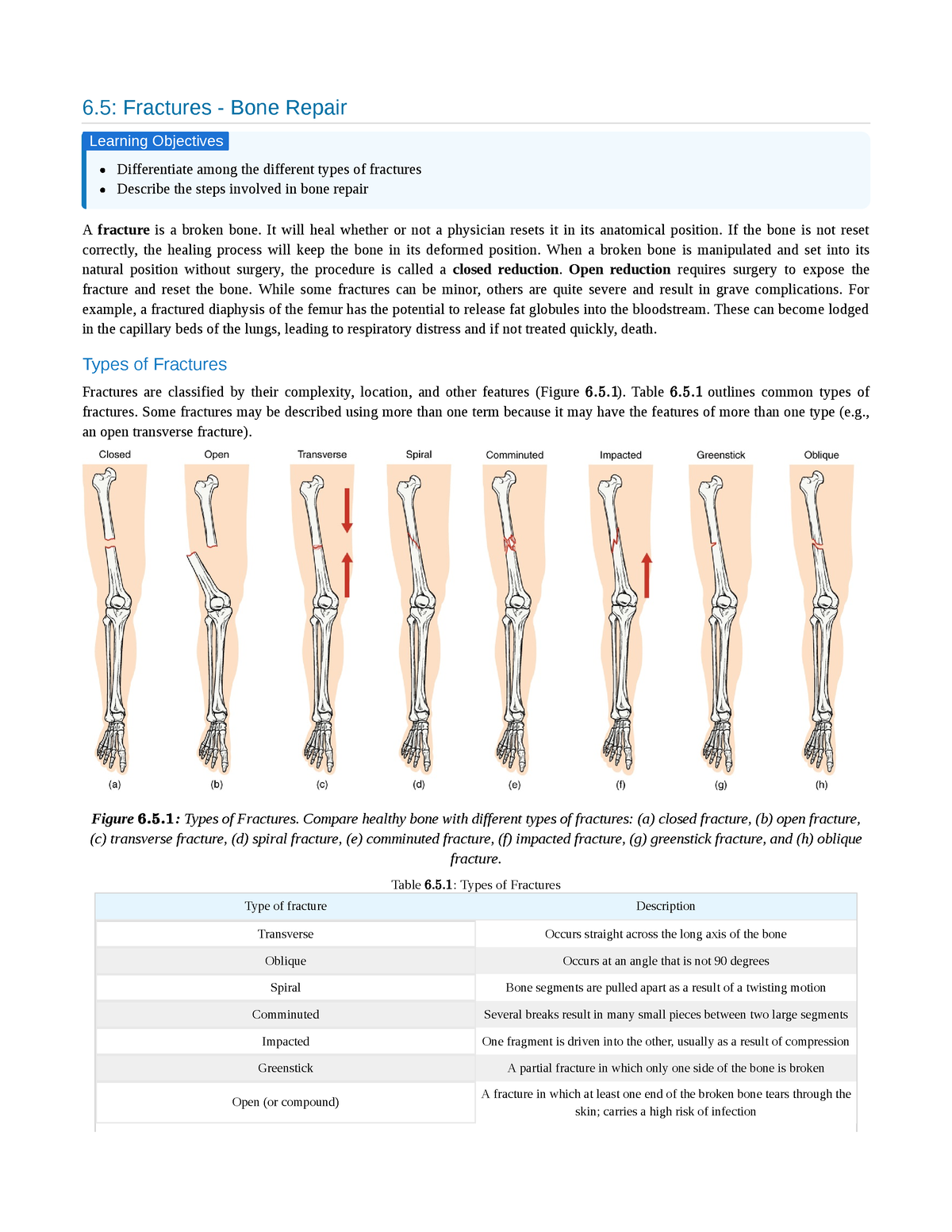 6.5 Fractures - Bone Repair - 6: Fractures - Bone Repair Differentiate ...