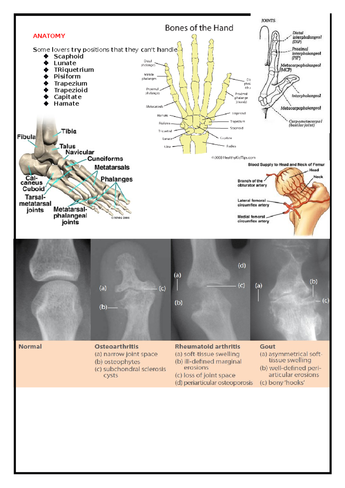 MSK Document - Notes on all of MSK from lectures. - ANATOMY Some lovers ...