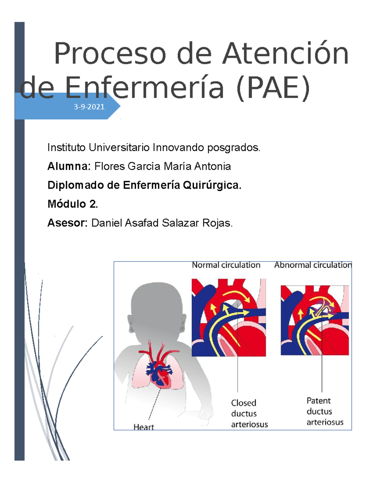 Proceso De Atención De Enfermería (PAE) - 3-9- Proceso De Atención De ...