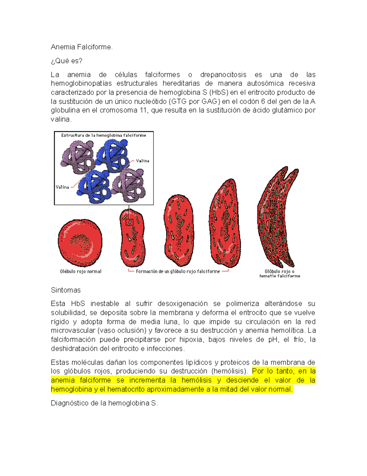 Anemia Falciforme - ¿Qué es? La anemia de células falciformes o ...