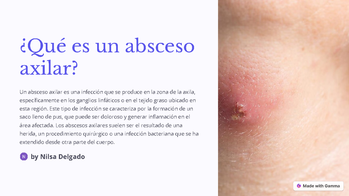 Que Es Un Absceso Axilar ¿qué Es Un Absceso Axilar Un Absceso Axilar Es Una Infección Que Se 1273