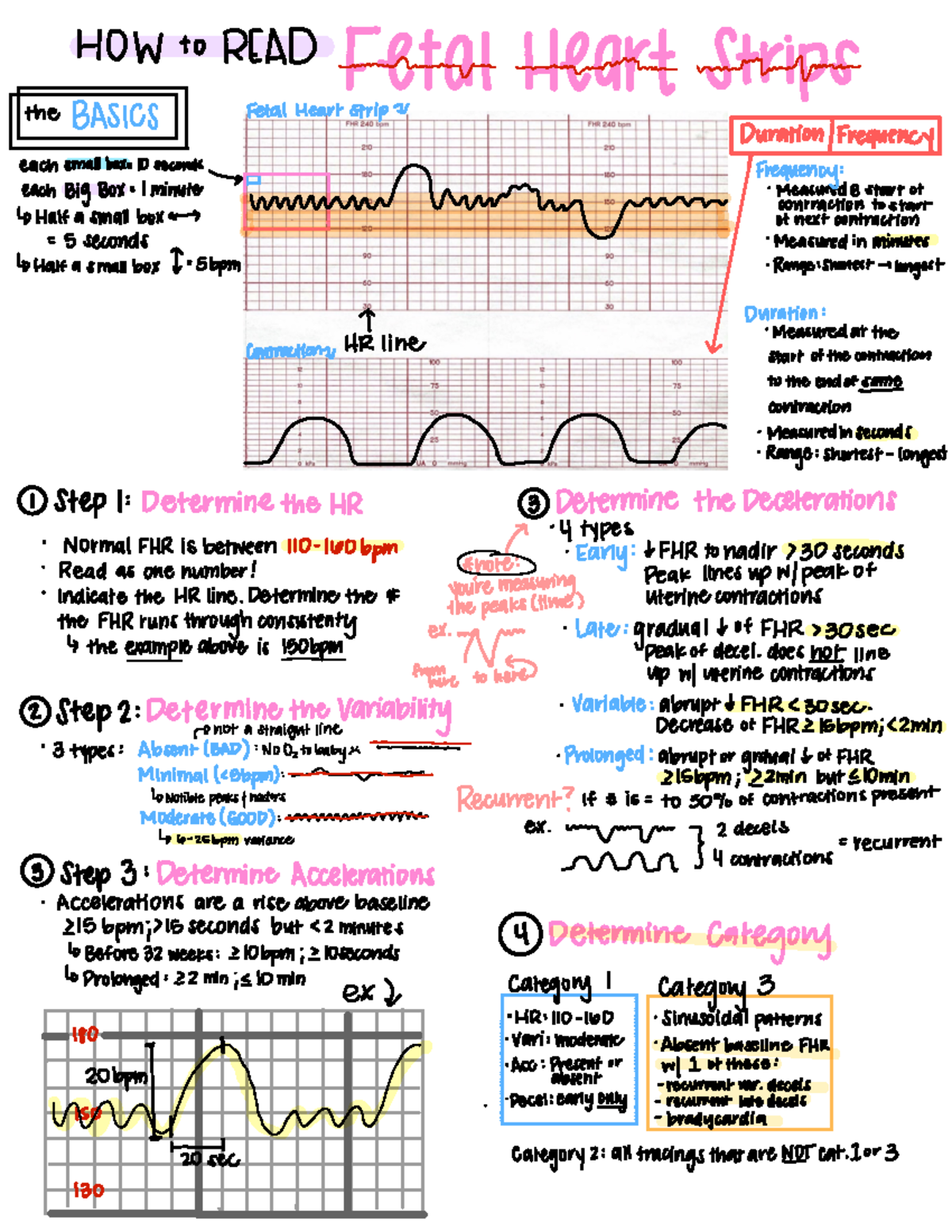 OB prework and fetal heart tracing - HOW to READ ...