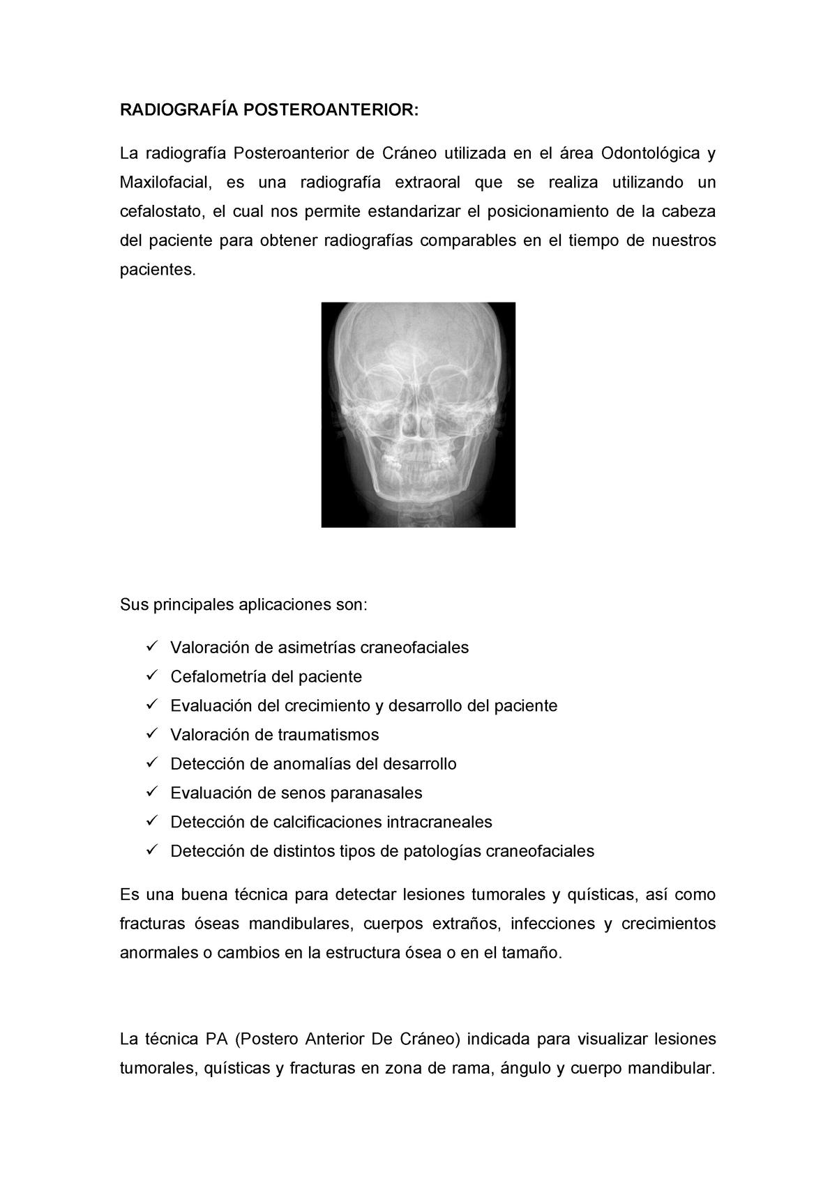 Radiografía Postero Anterior De Cráneo RadiografÍa Posteroanterior La Radiografía 3680