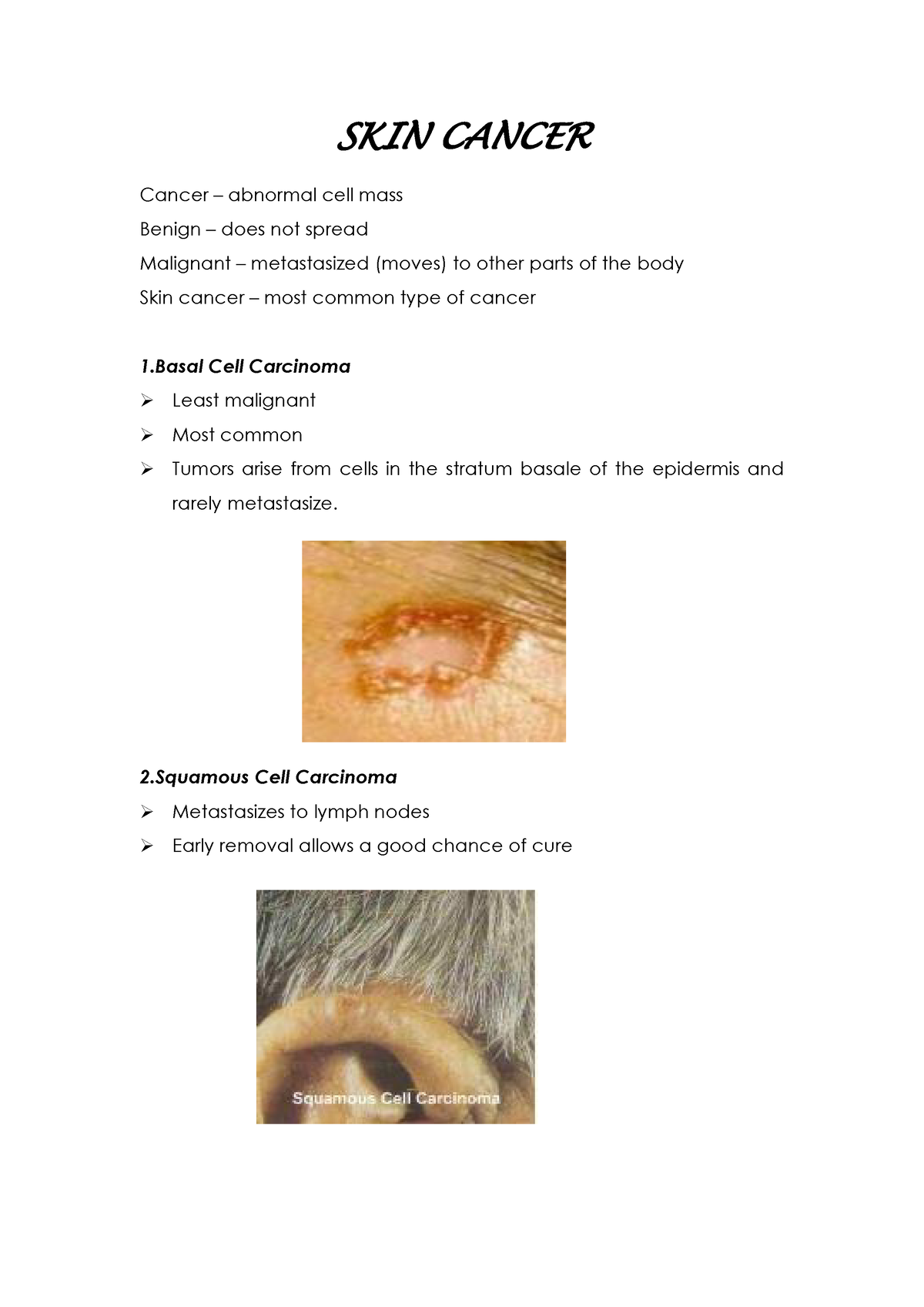 SKIN Cancer - academic guides - SKIN CANCER Cancer – abnormal cell mass ...