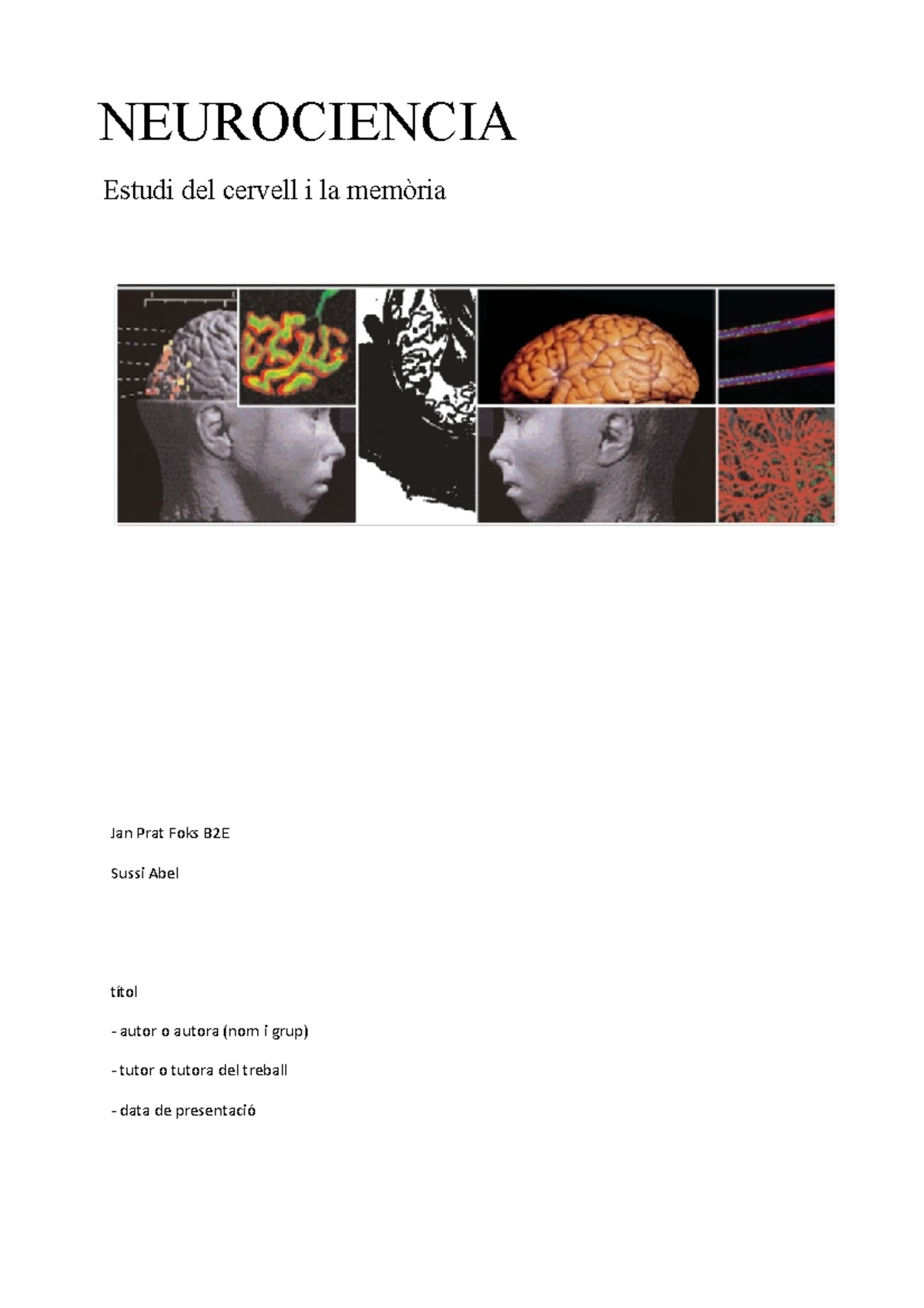 Neurociencia - Biologia - NEUROCIENCIA Estudi Del Cervell I La Memòria ...