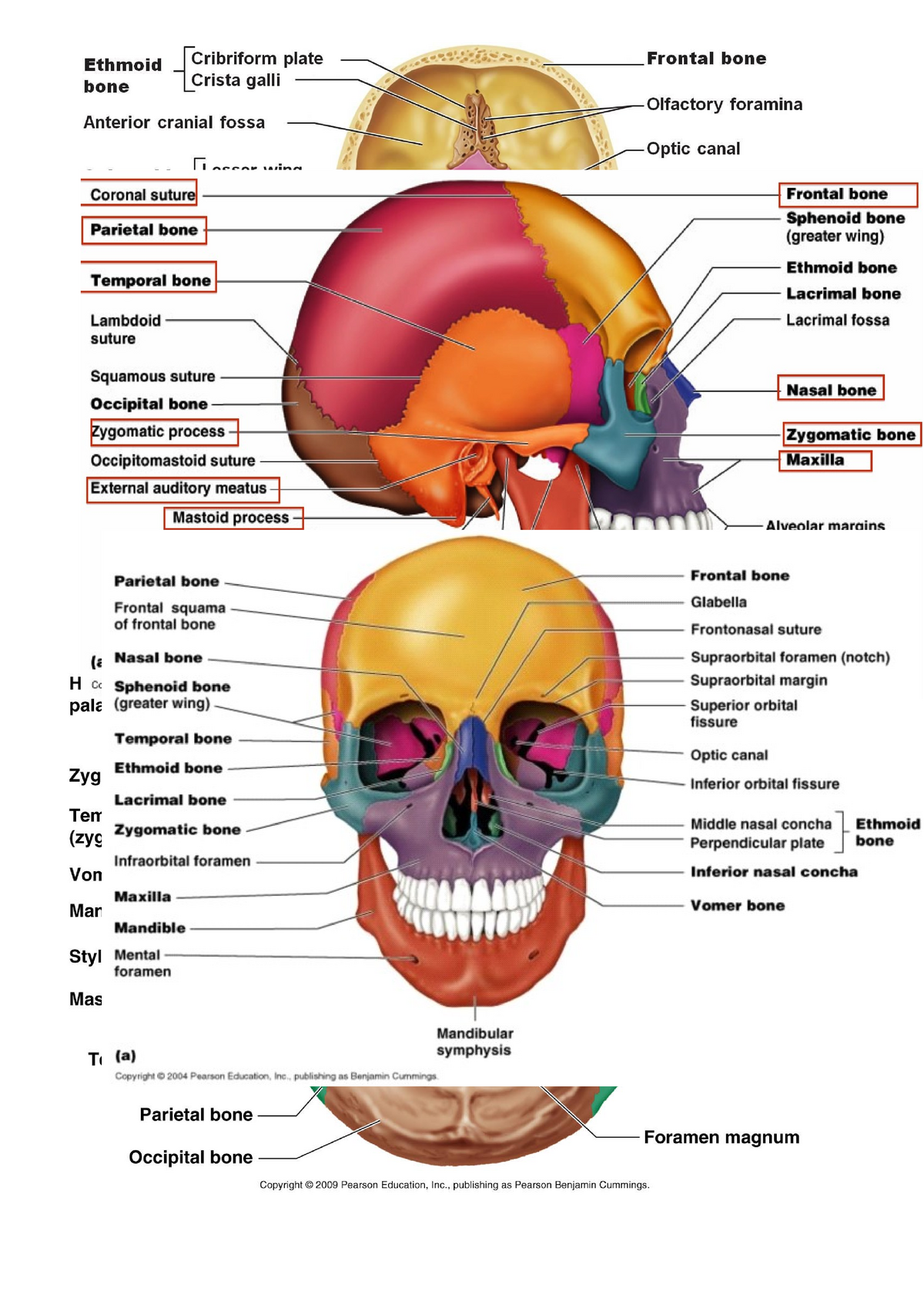 Anatomy diagrams BM1072 - Ethmoid Cribriform plate bone Crista galli ...