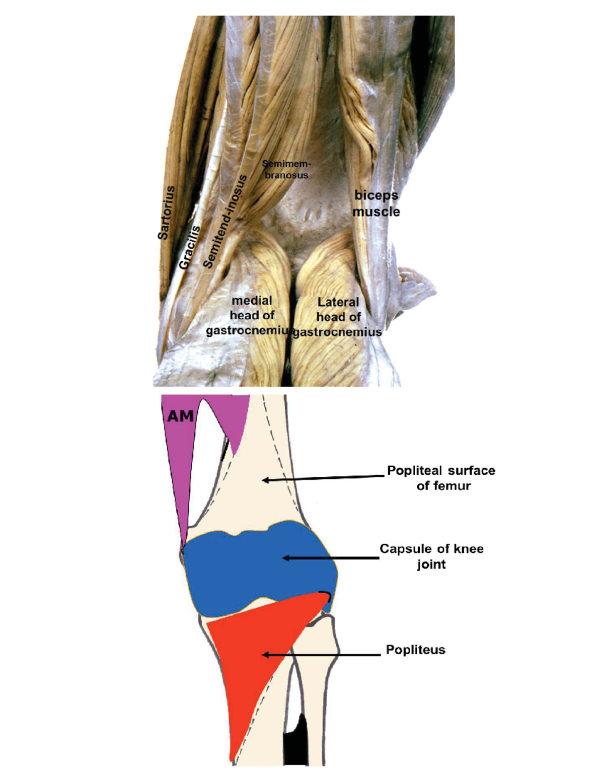 Lower limb 2 Gluteal region 1. Gluteus Maximus (main extensor of hip