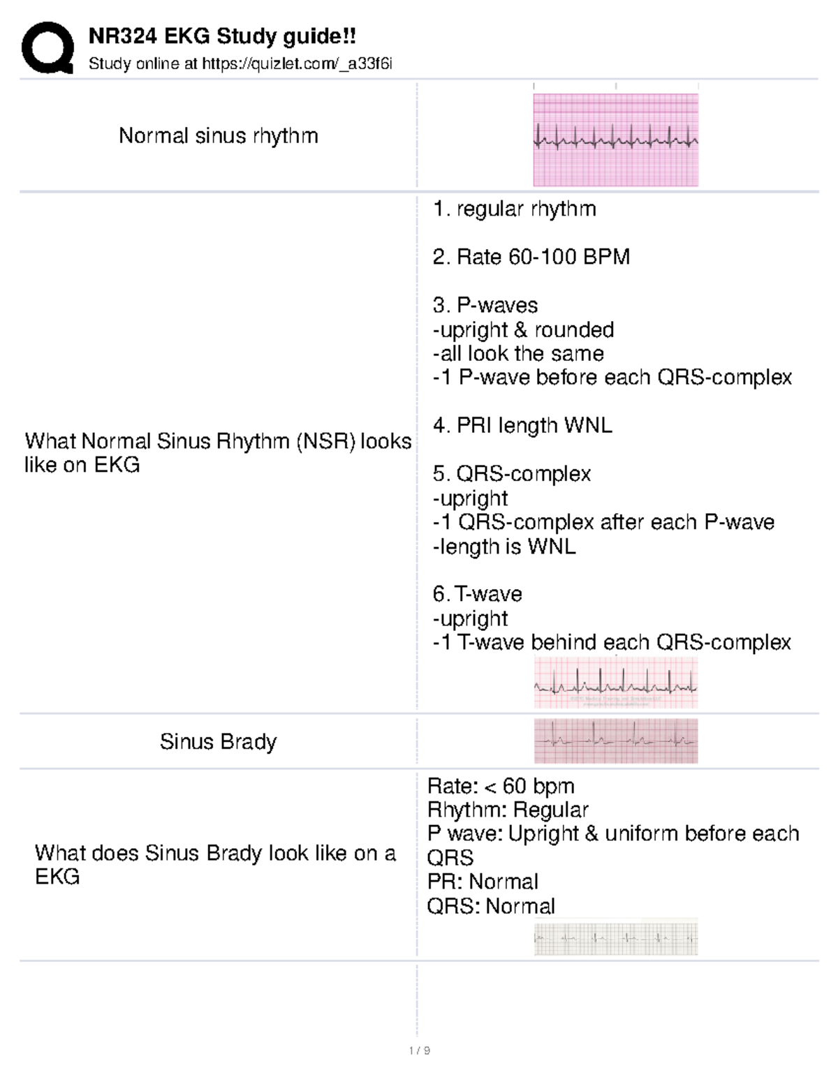 NR324 EKG Study guideQuizlet Study online at quizlet/_a33f6i Normal