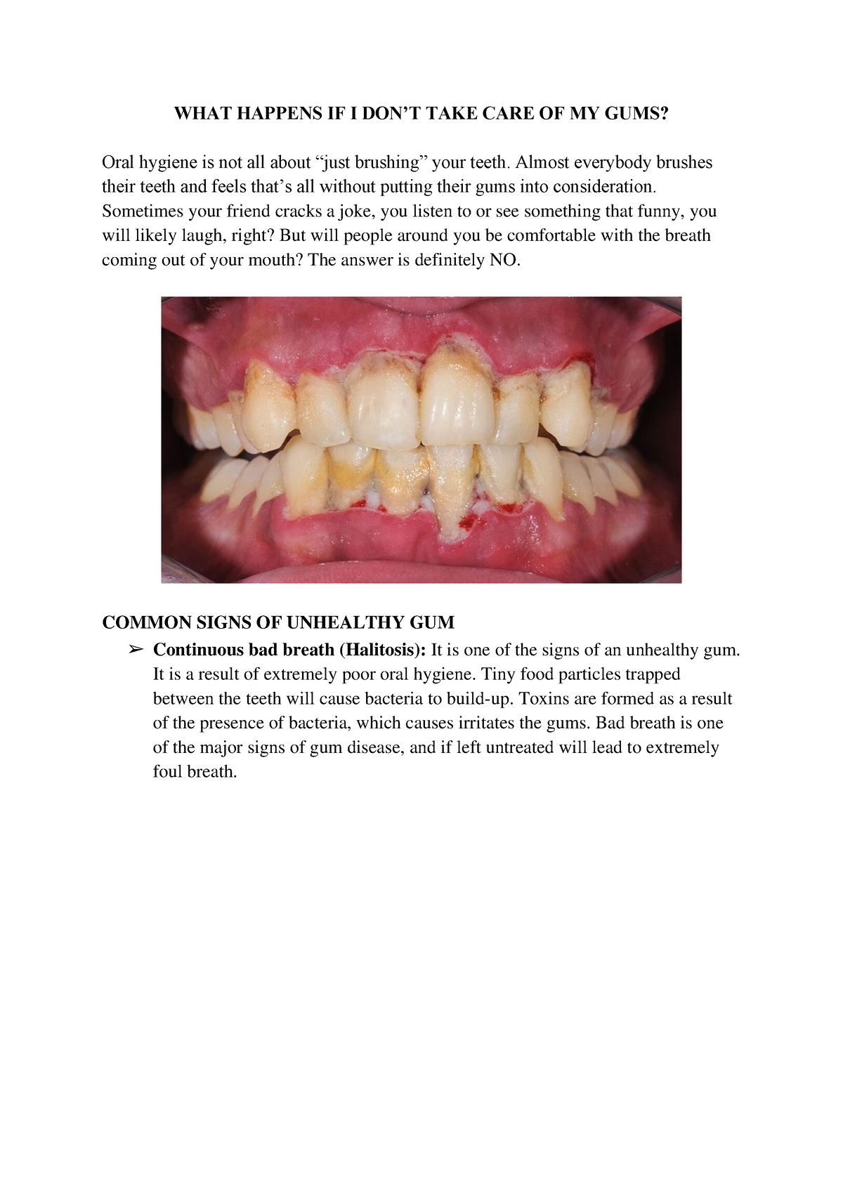 WHAT+ Happens+IF+I+DONE28099T+TAKE+CARE+OF+MY+GUMS+ WHAT HAPPENS