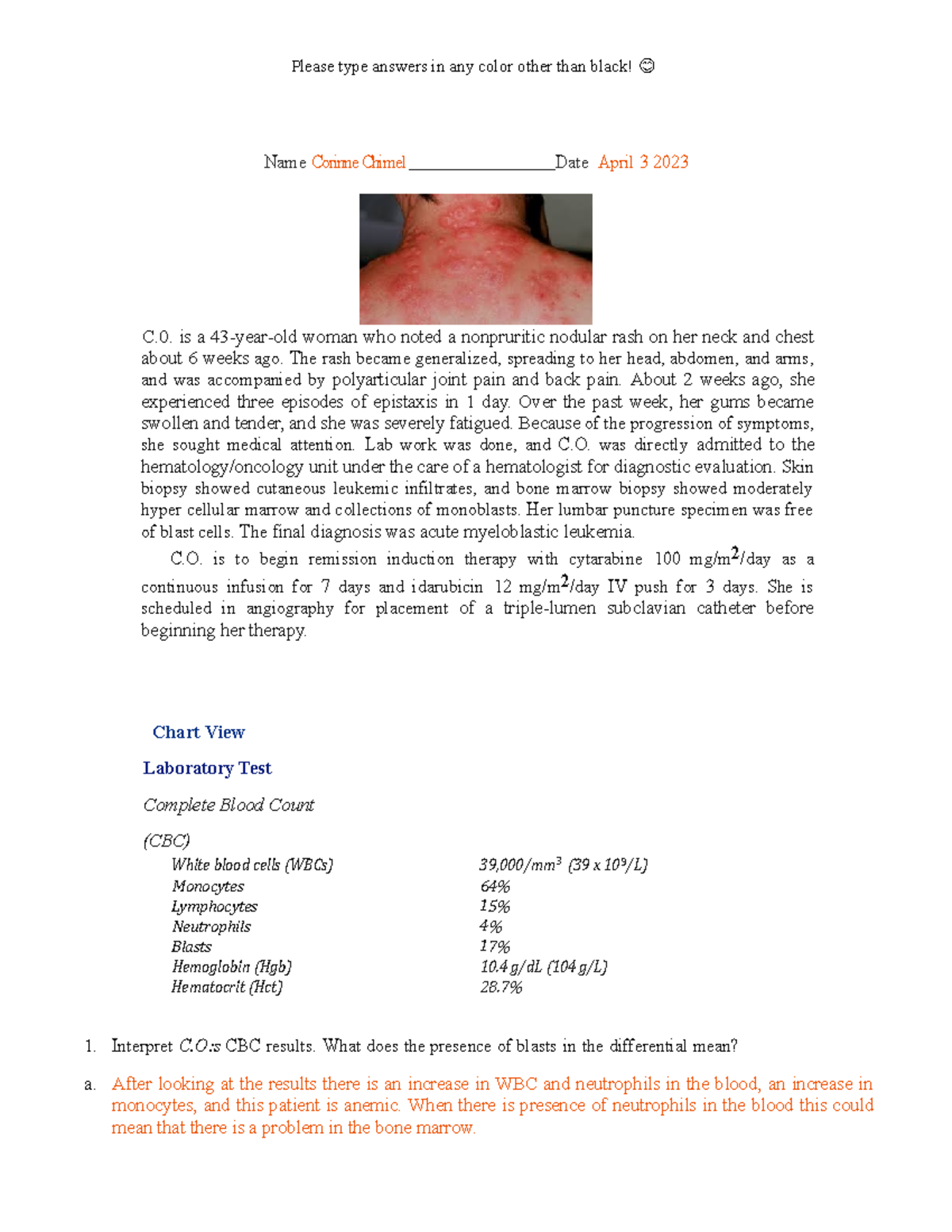 Leukemia Case Study - Name Corinne Chimel Date April 3 2023 C. is a 43 ...