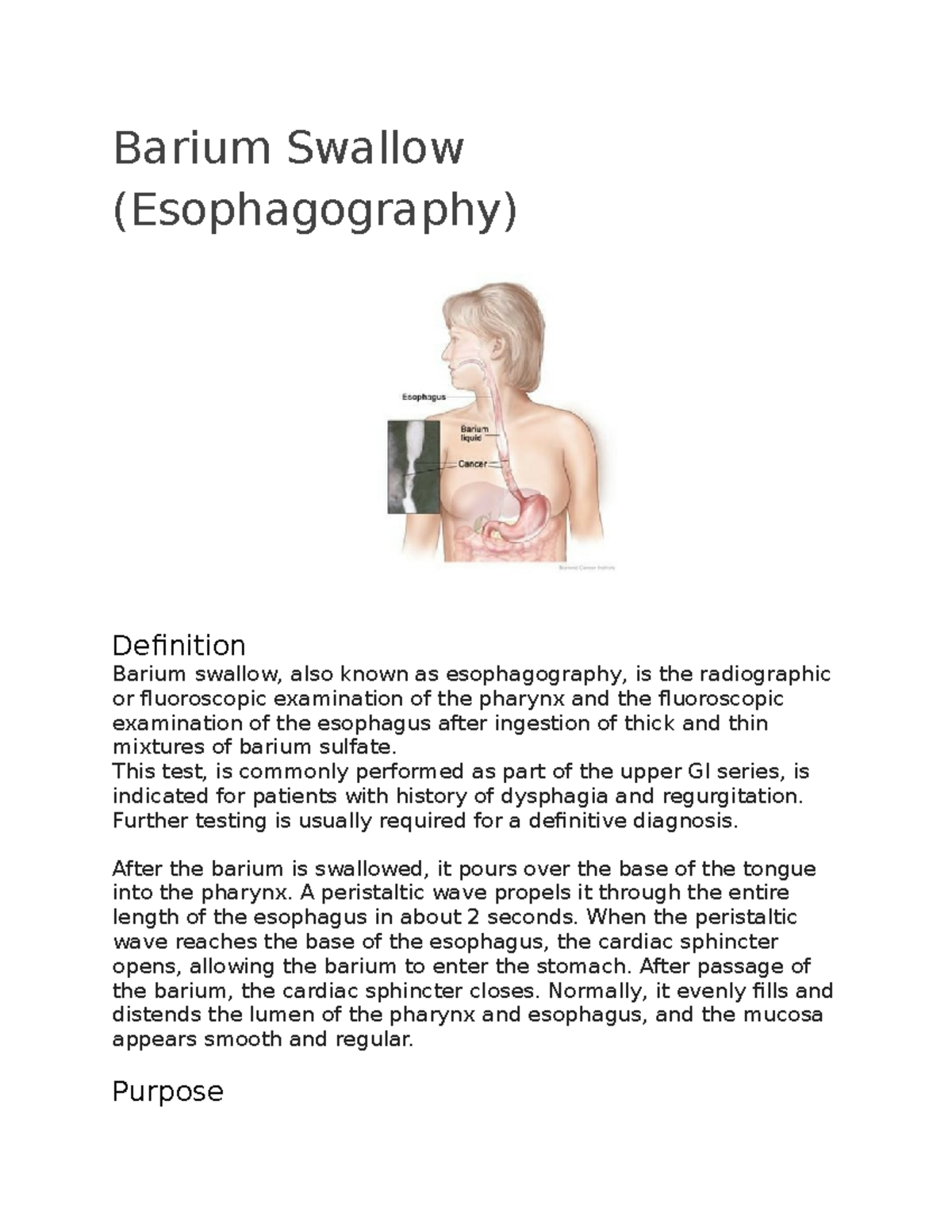 Barium Swallow (Esophagography) Barium Swallow (Esophagography) Definition Barium swallow