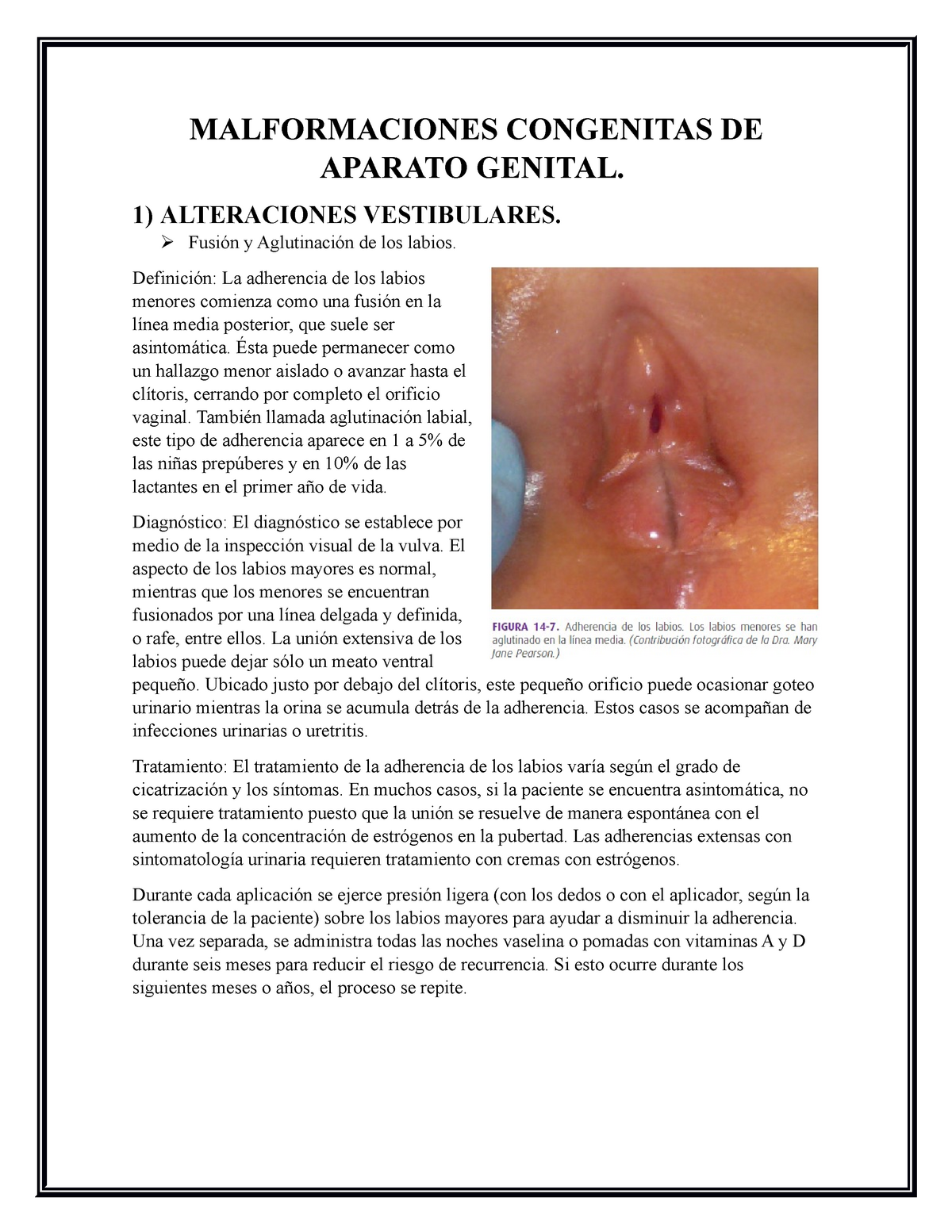 Tema Ii Enfermedades Vulvares Y Vaginales Malformaciones Congenitas De Aparato Genital