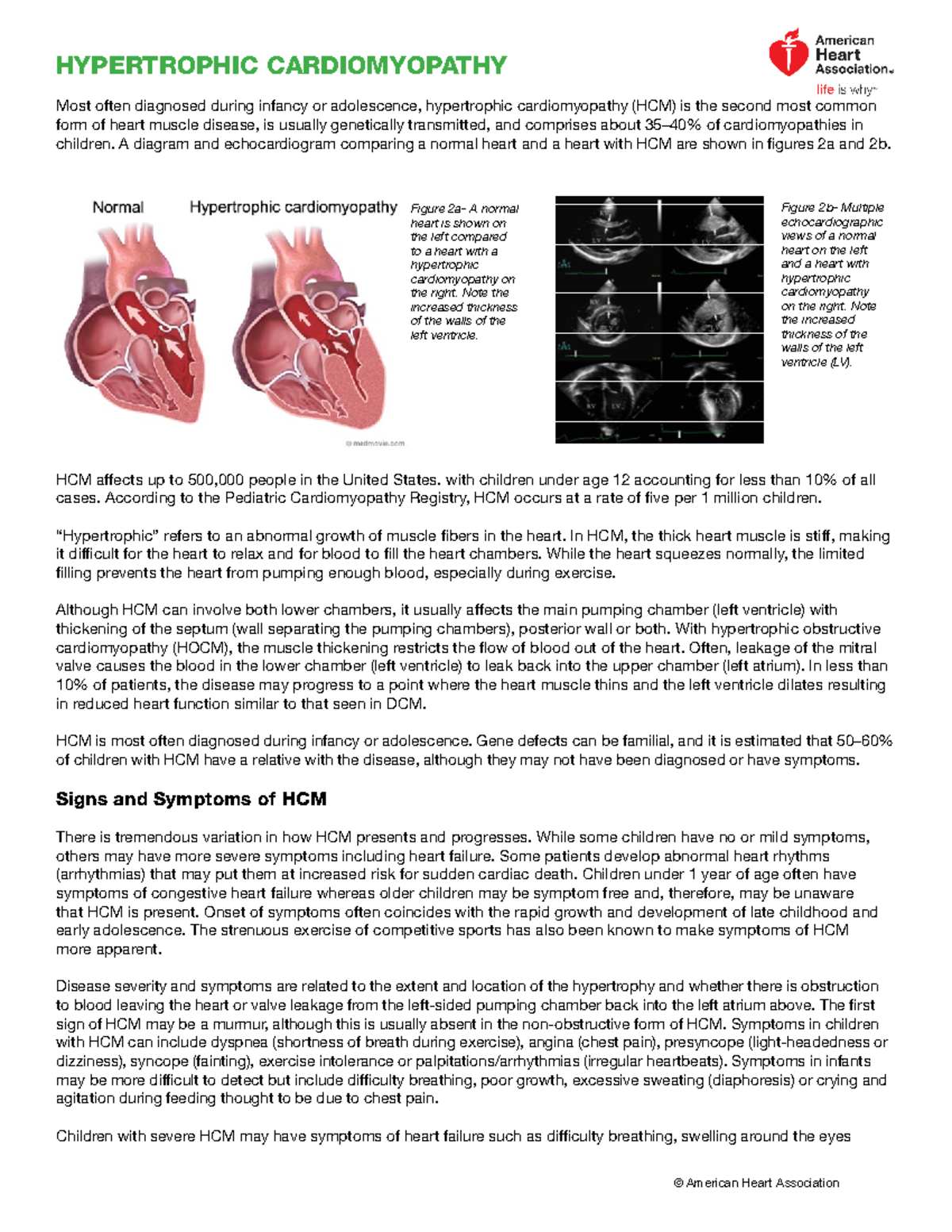 Hypertrophic Cardiomyopathy Ucm 312225 Hypertrophic Cardiomyopathy