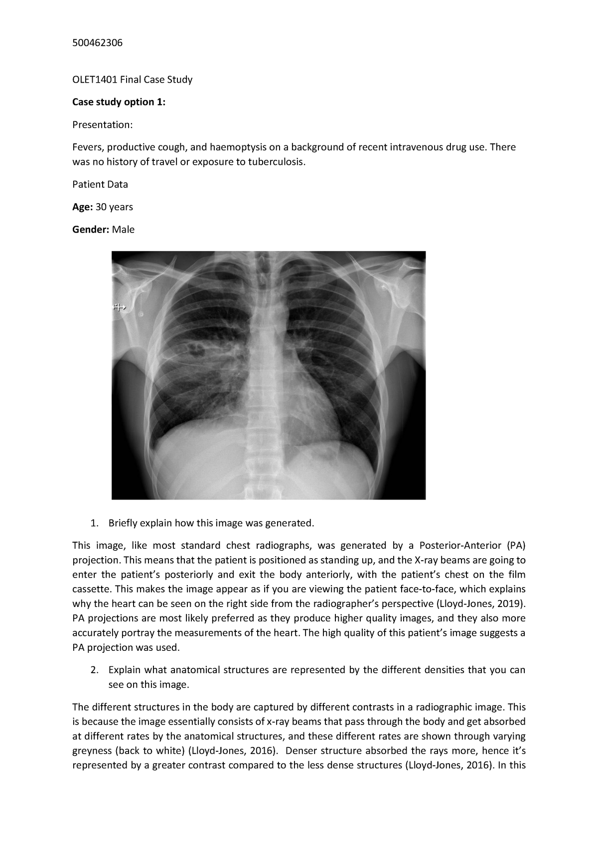 chest x ray case study